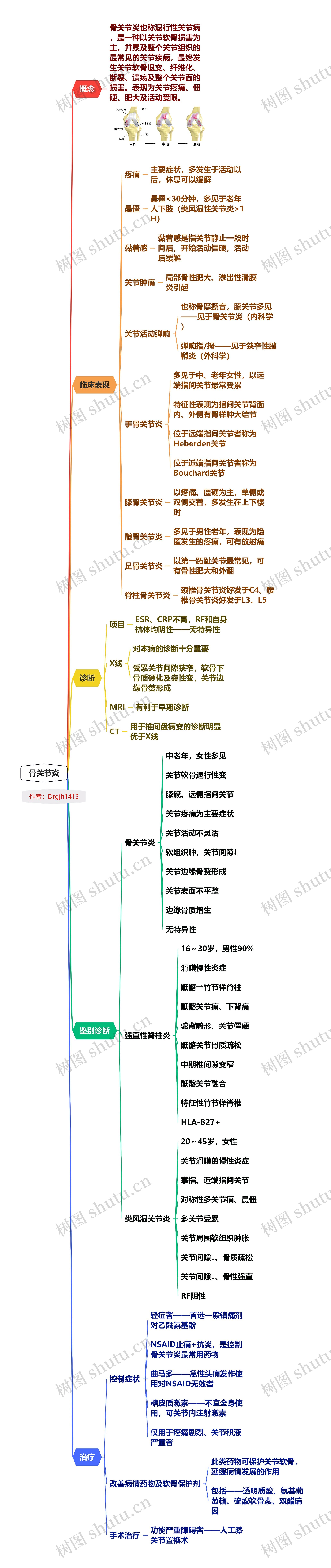 骨关节炎思维导图高清图 骨关节炎思维导图