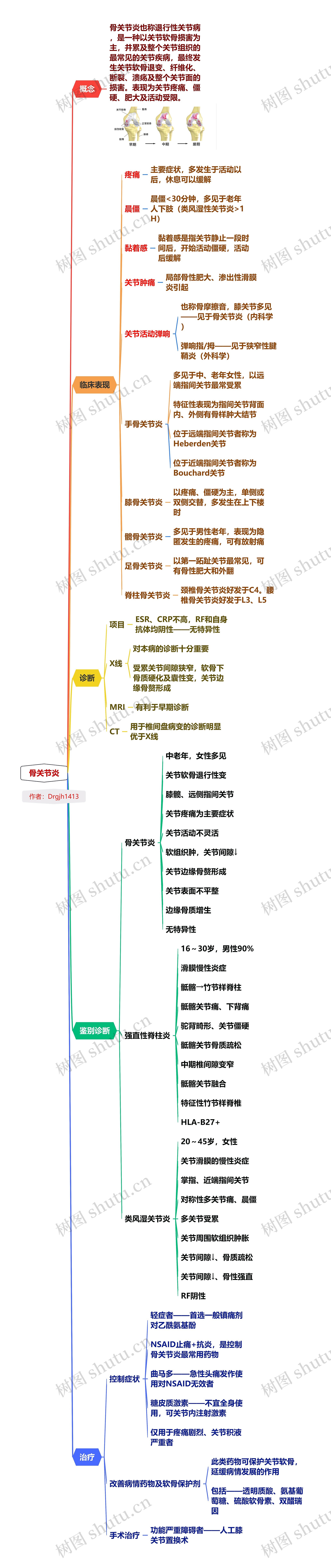 骨关节炎思维导图高清图 骨关节炎思维导图