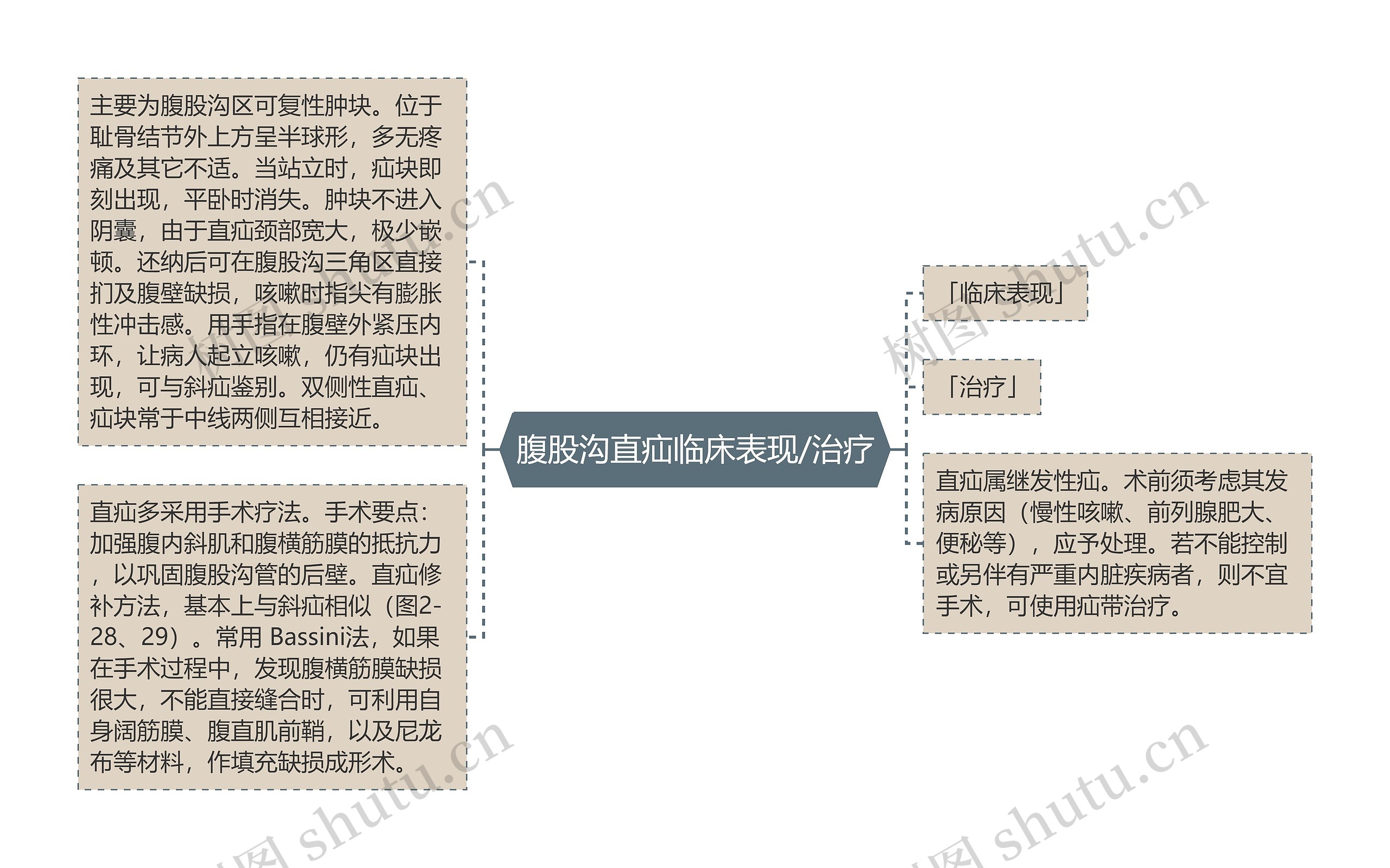 腹股沟直疝临床表现/治疗