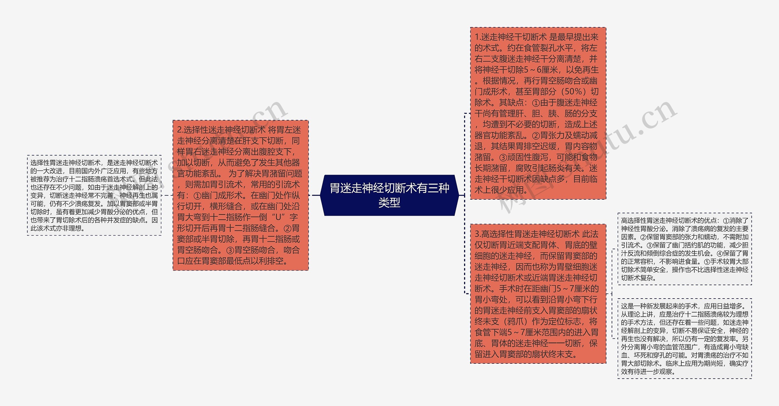 胃迷走神经切断术有三种类型