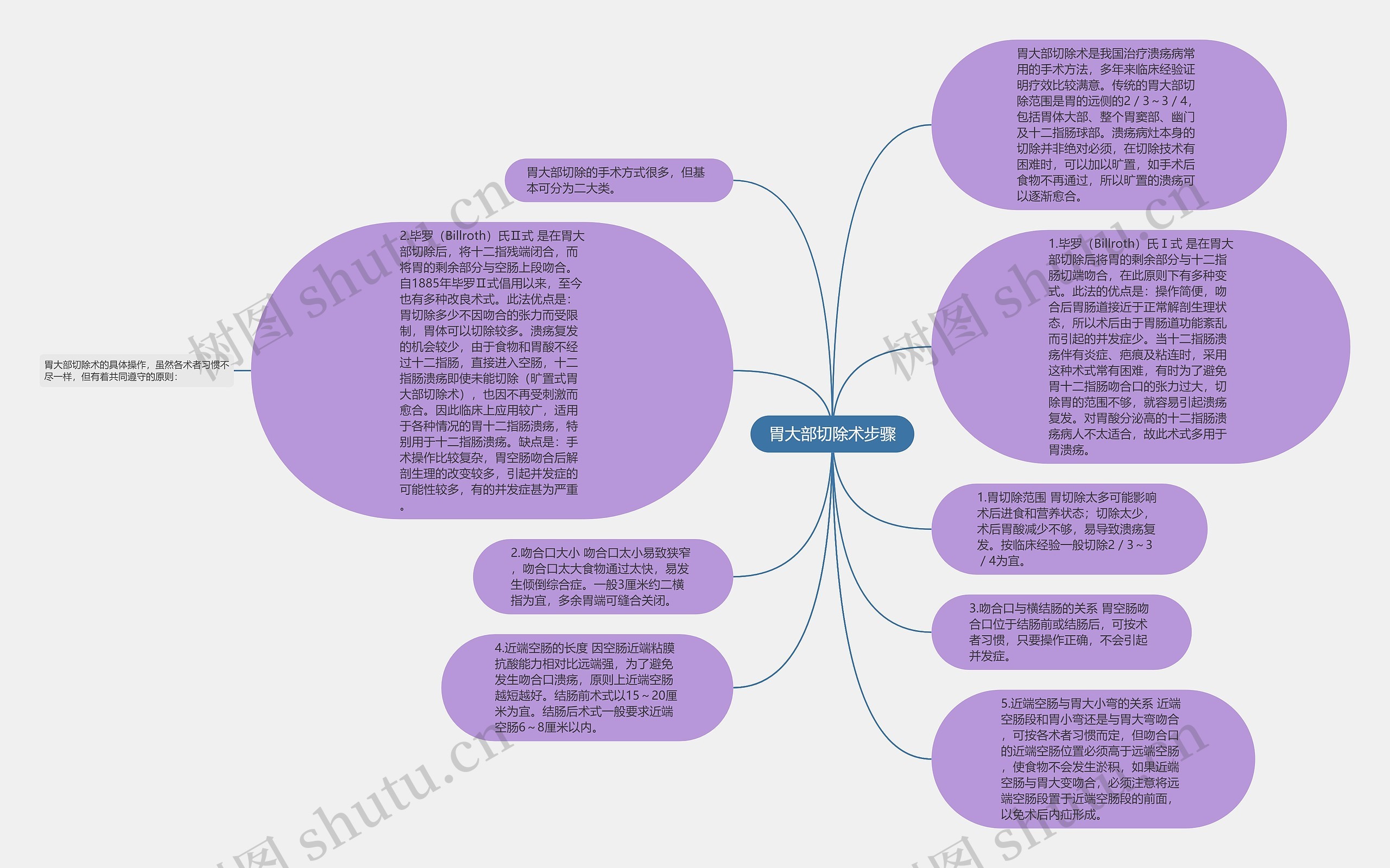胃大部切除术步骤思维导图
