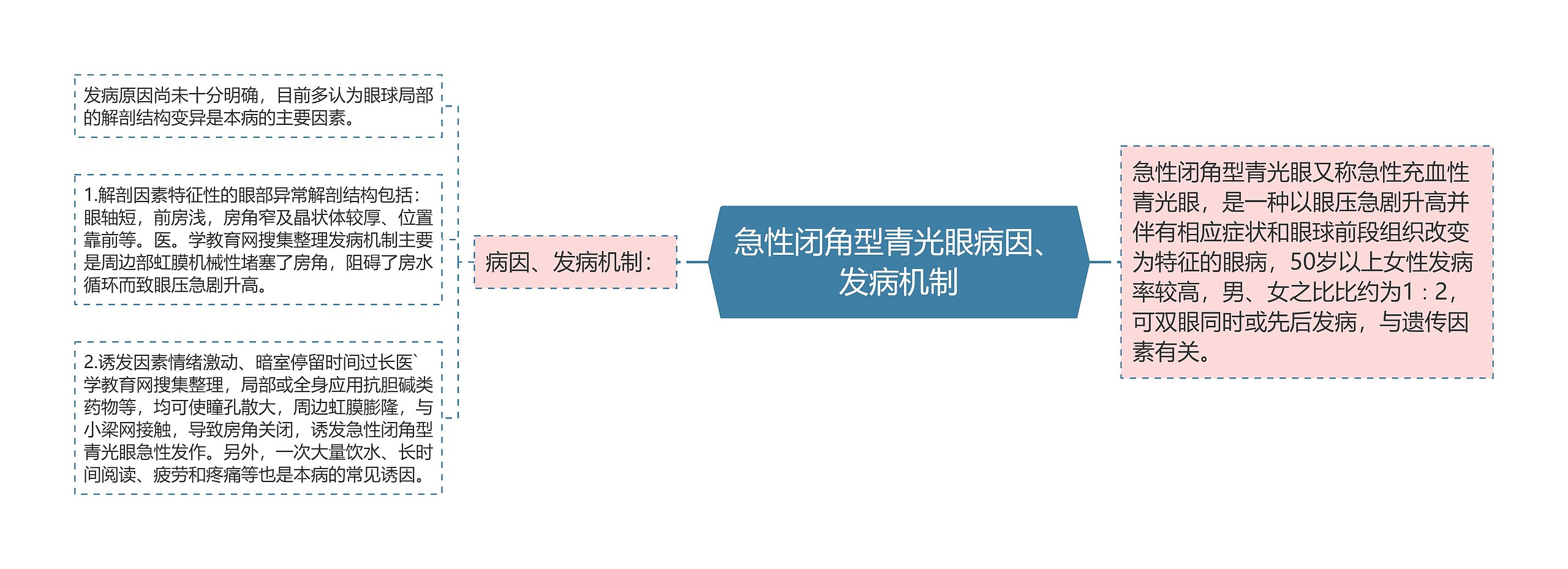 急性闭角型青光眼病因、发病机制思维导图