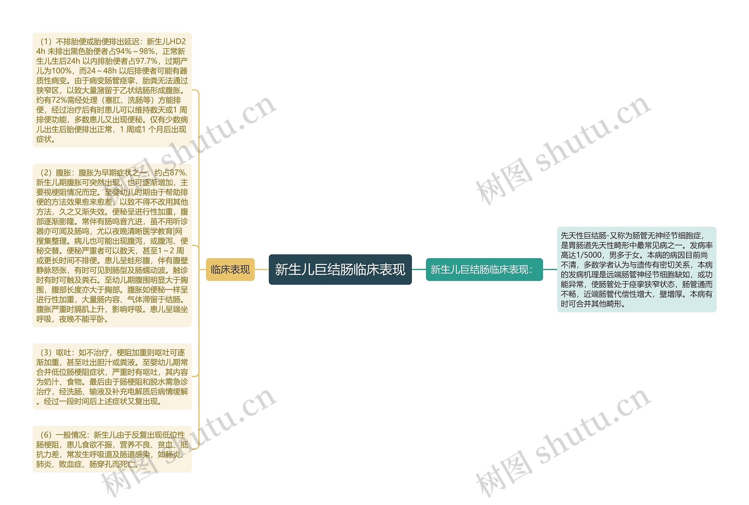 新生儿巨结肠临床表现思维导图