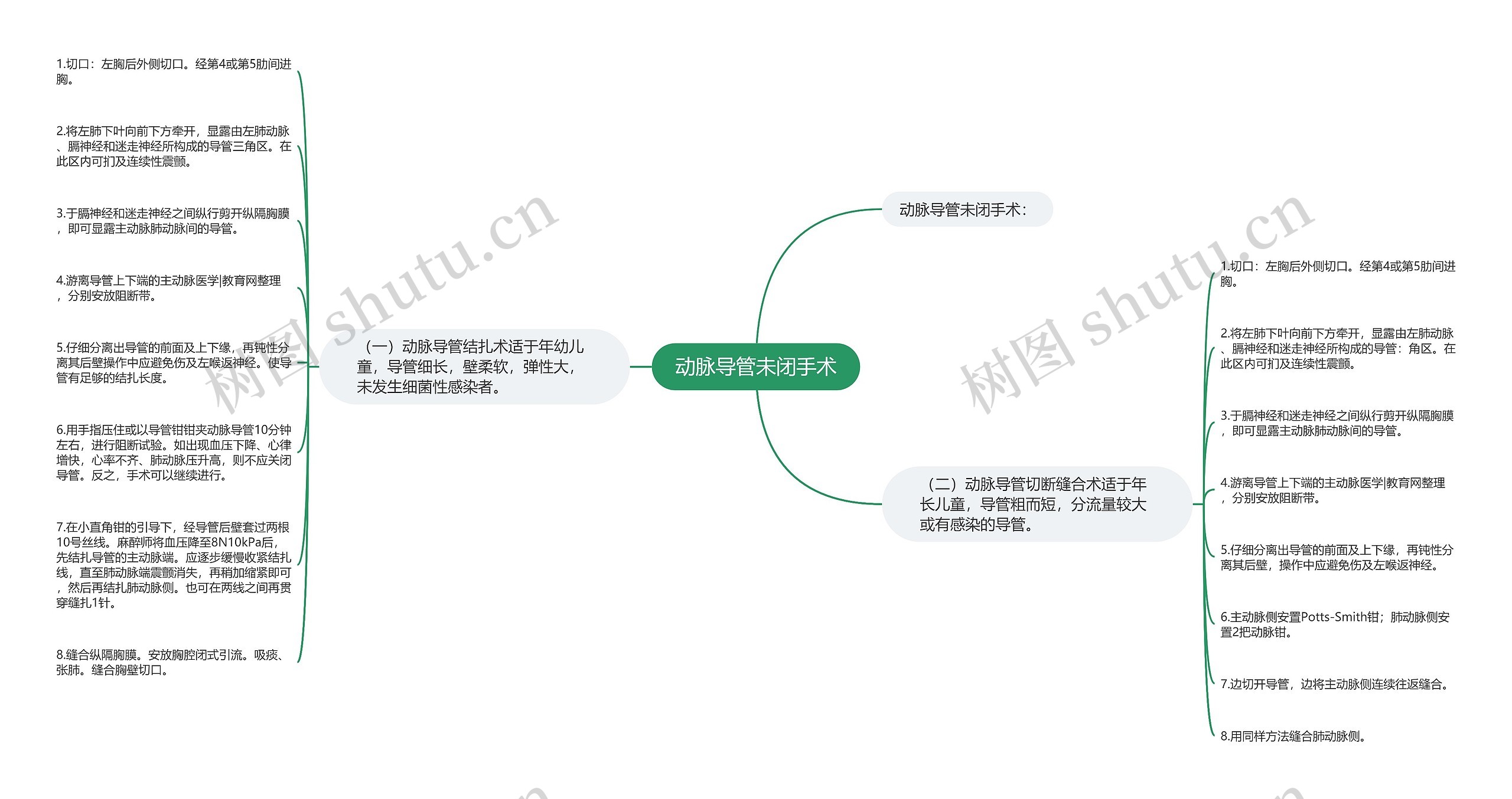 动脉导管未闭手术思维导图