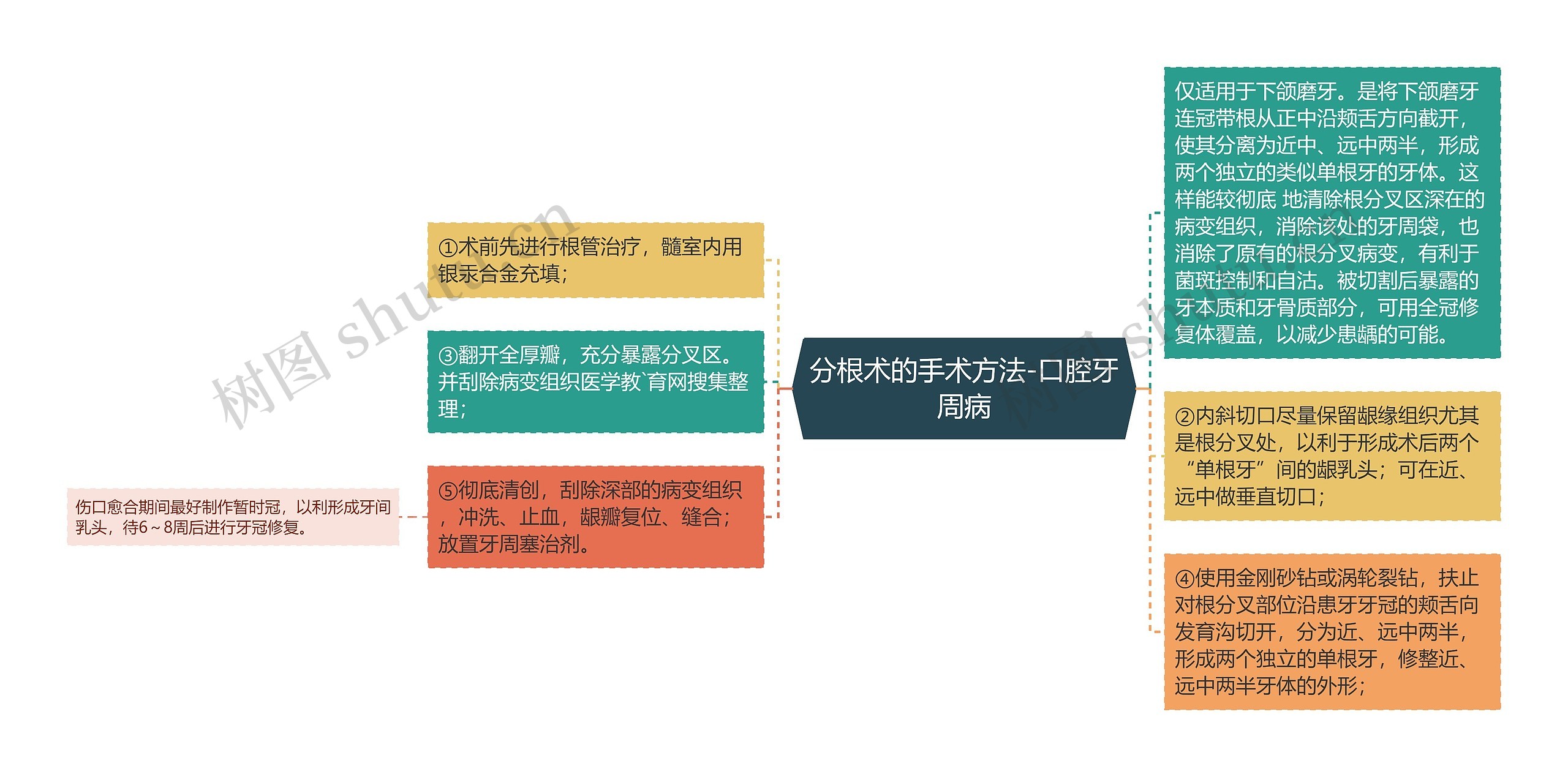 分根术的手术方法-口腔牙周病 分根术的手术方法-口腔牙周病