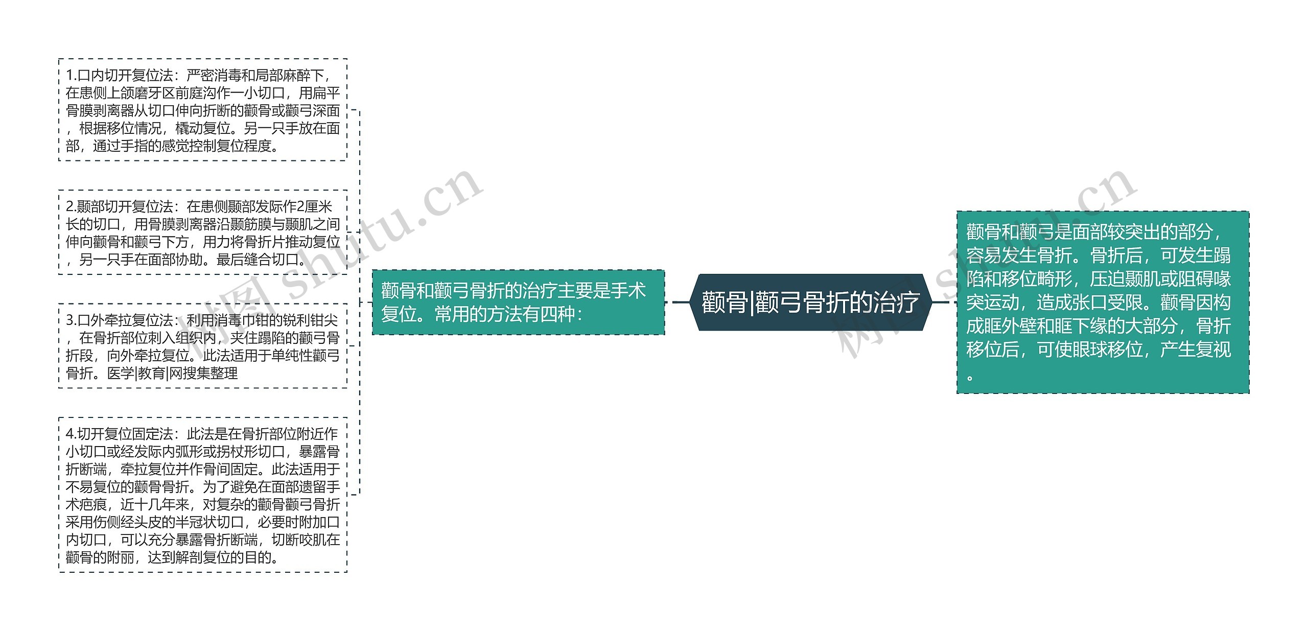 颧骨|颧弓骨折的治疗思维导图