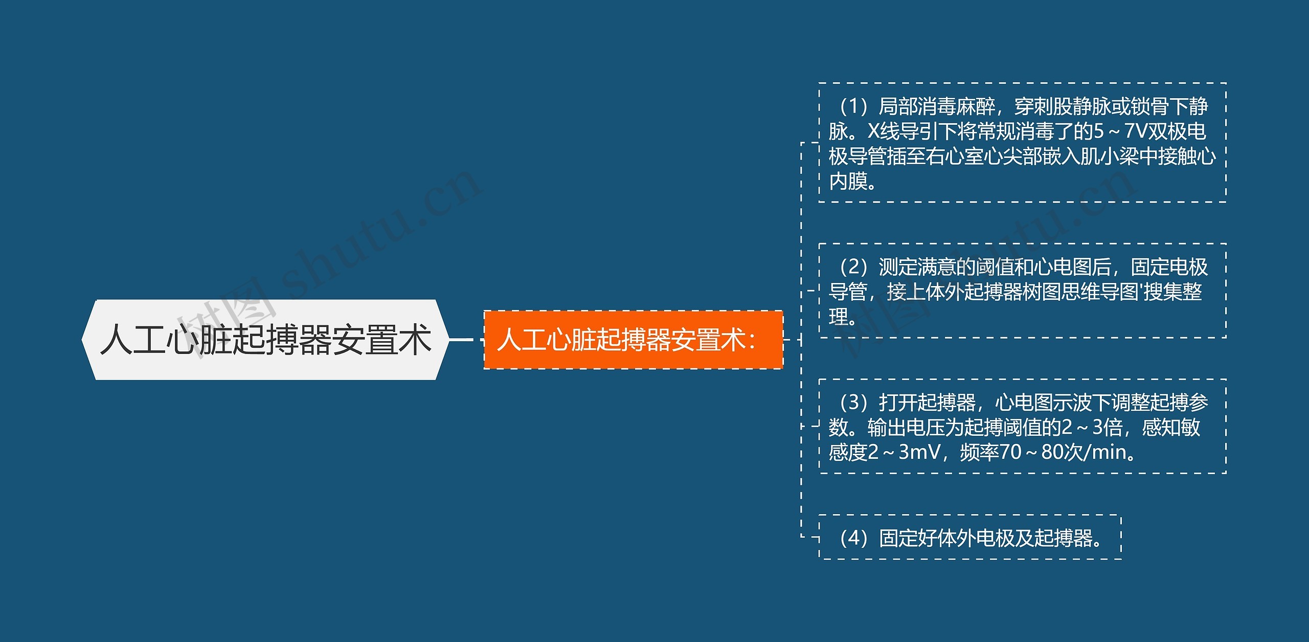 人工心脏起搏器安置术思维导图
