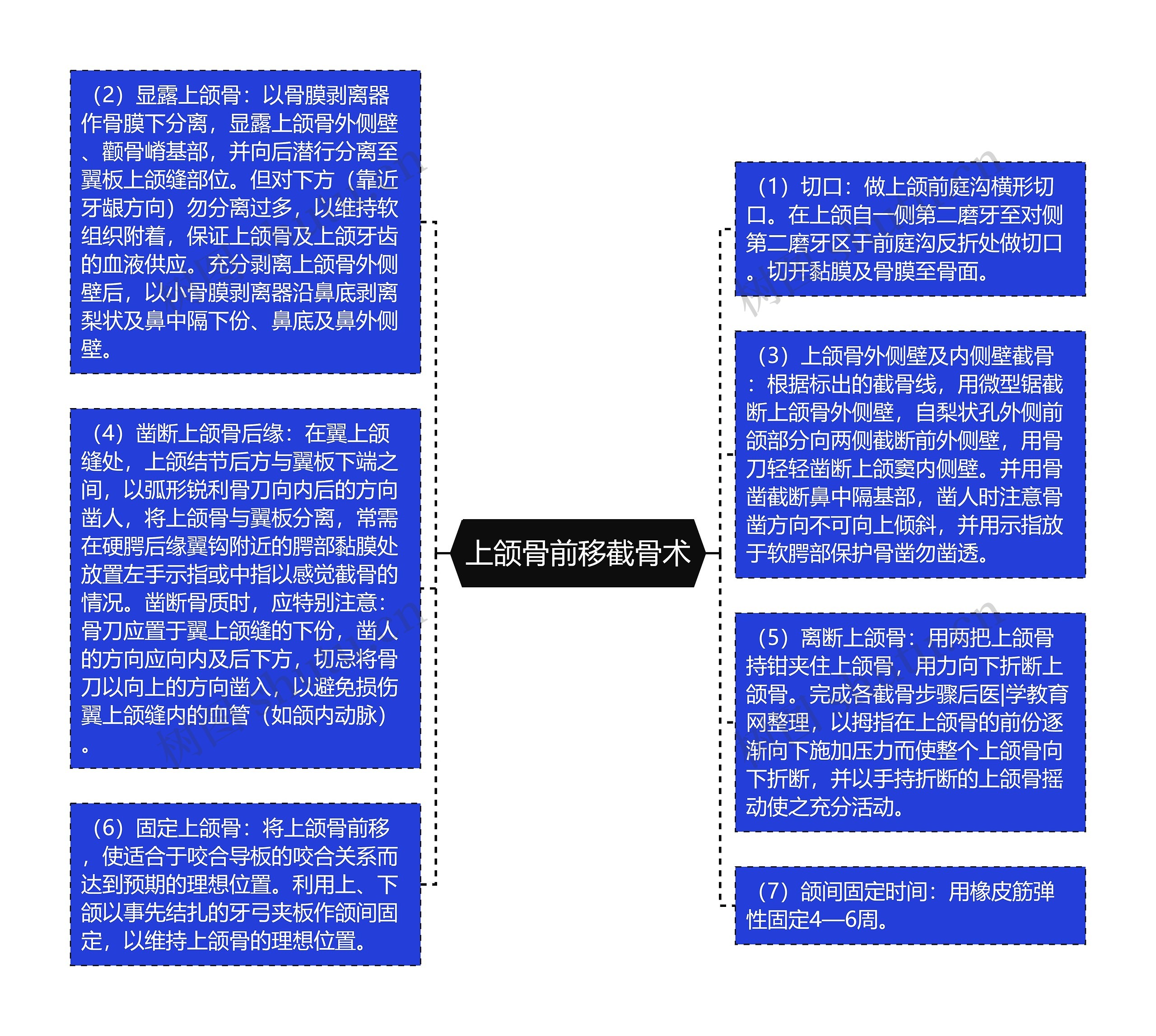 上颌骨前移截骨术思维导图