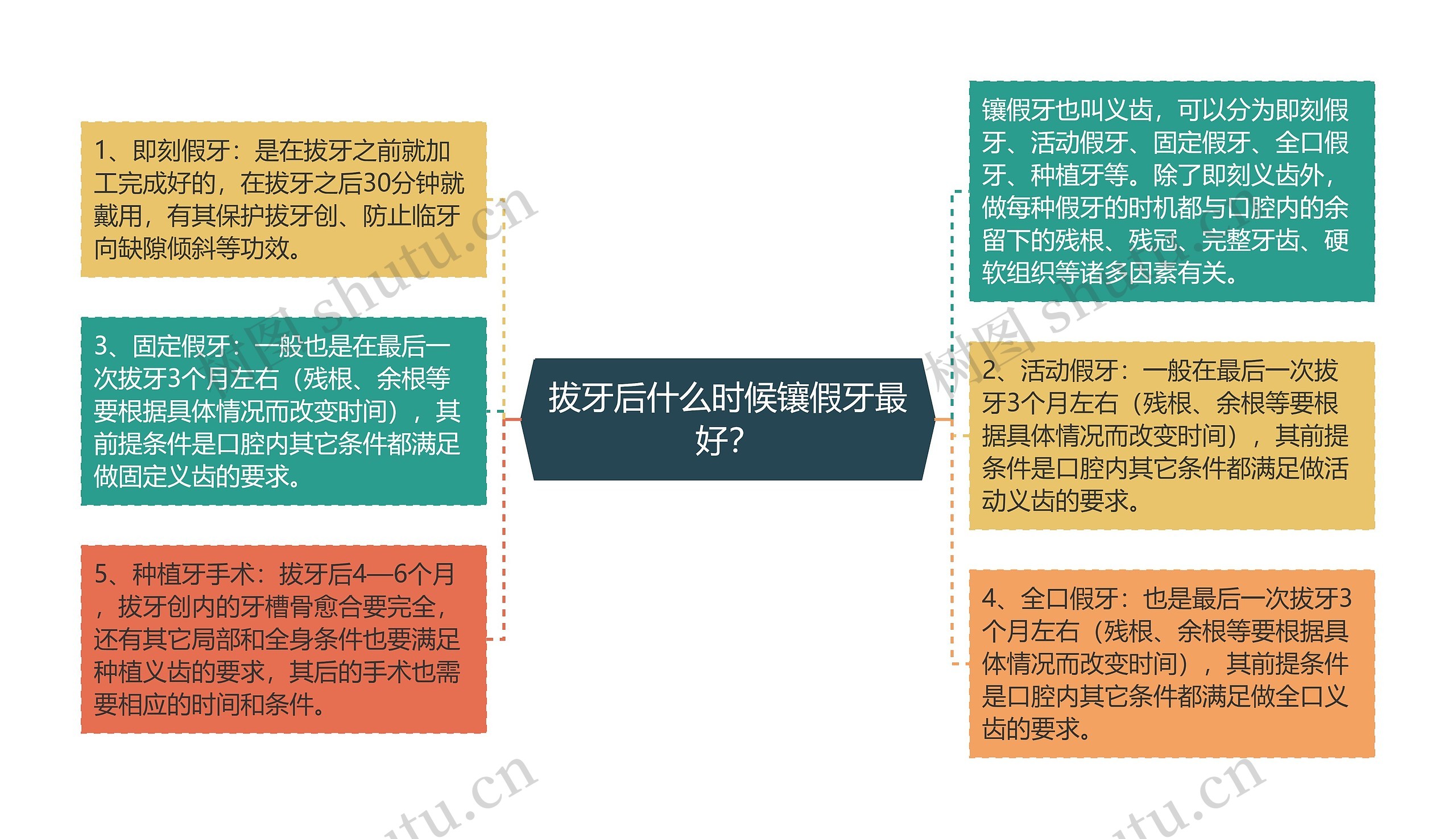 拔牙后什么时候镶假牙最好？思维导图