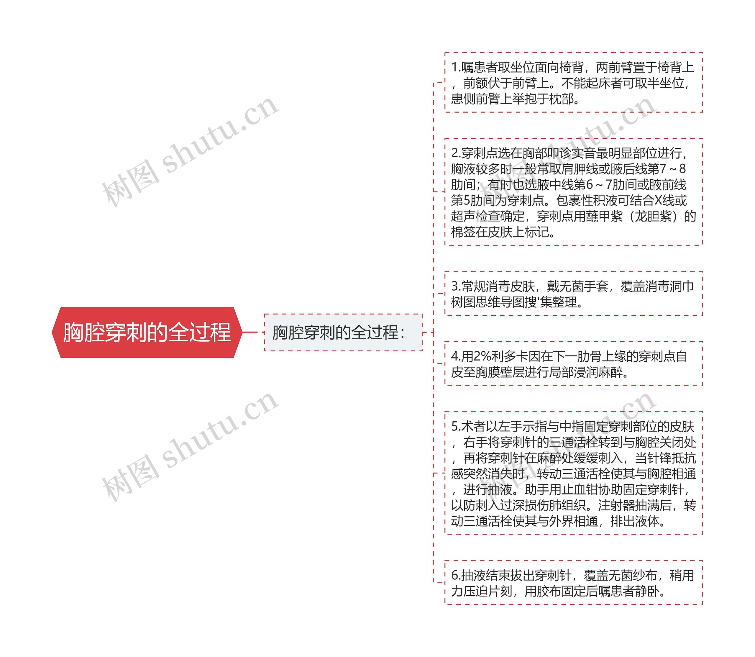 胸腔穿刺的全过程思维导图