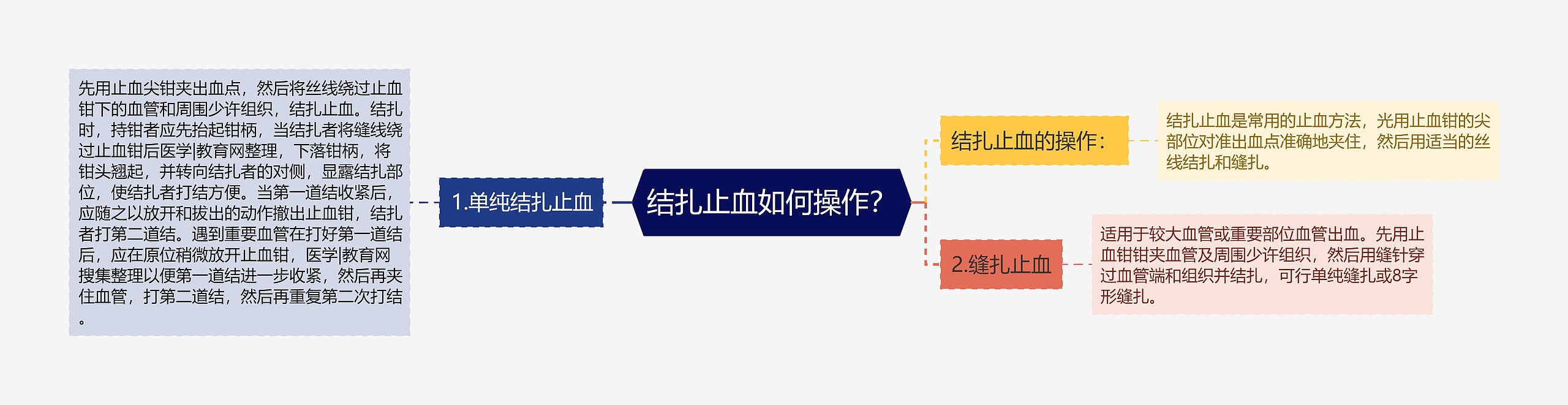 结扎止血如何操作？思维导图