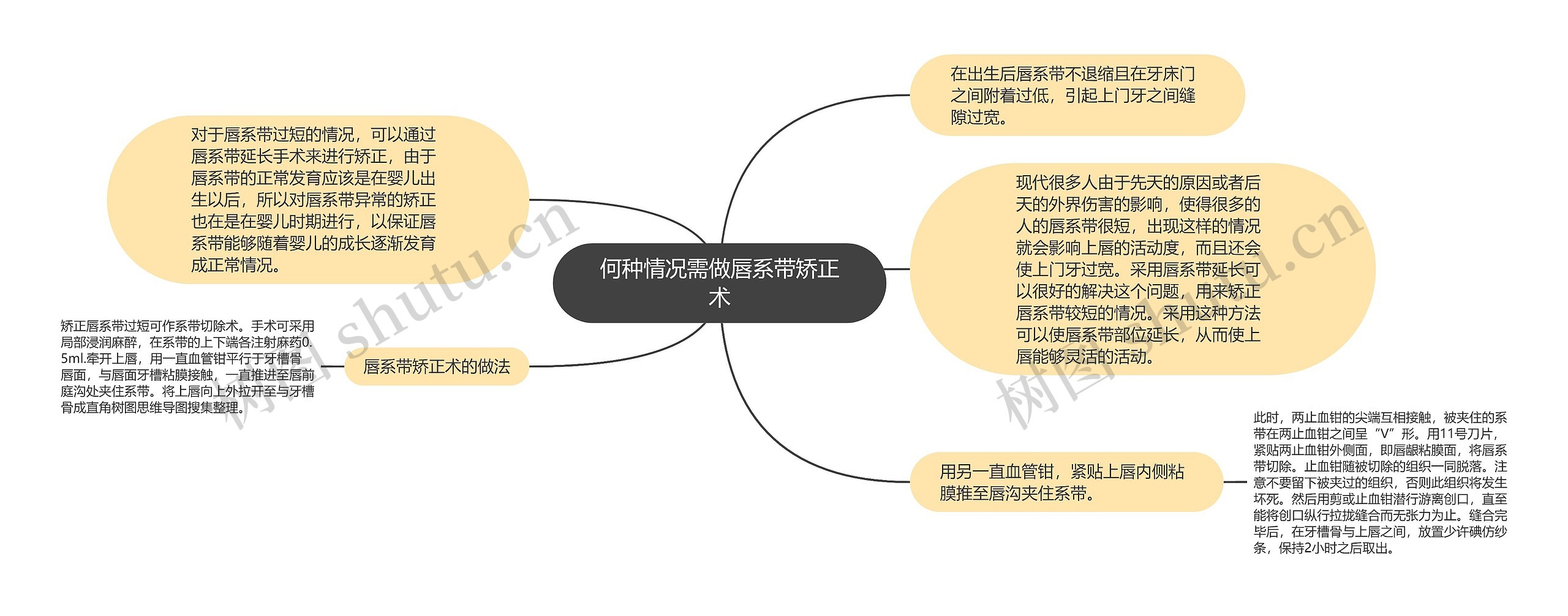 何种情况需做唇系带矫正术