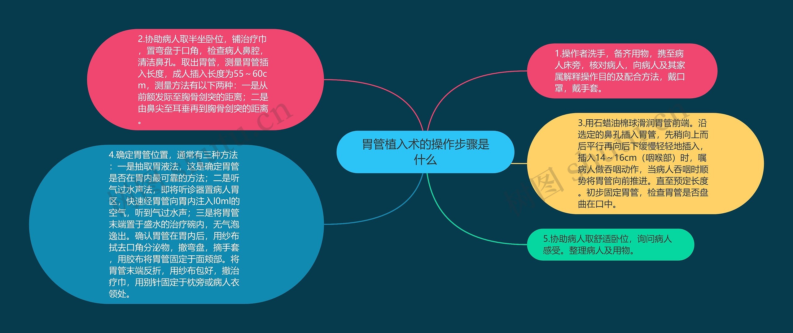 胃管植入术的操作步骤是什么思维导图