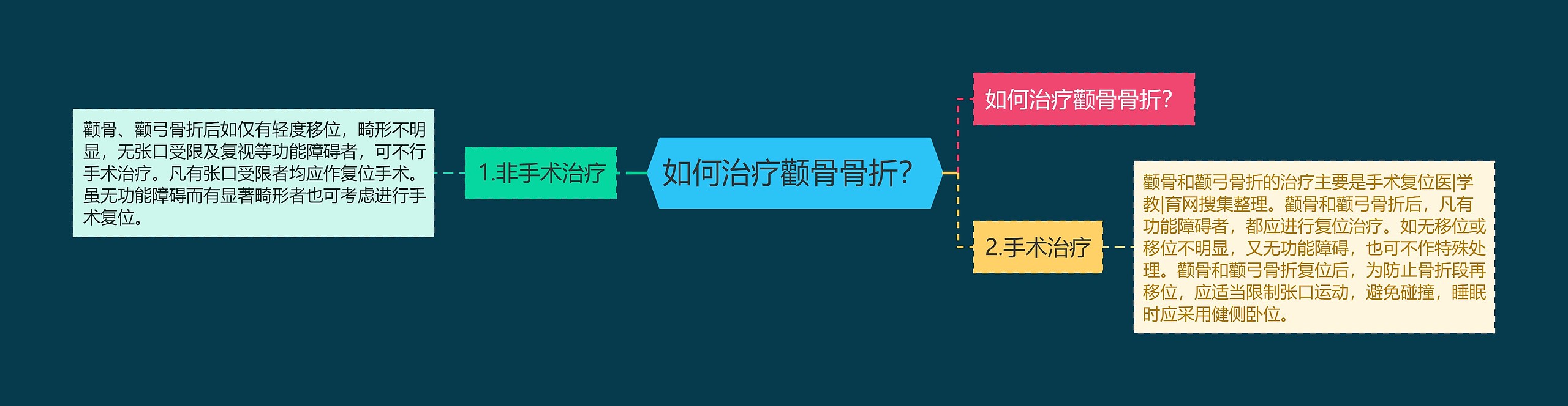 如何治疗颧骨骨折？思维导图