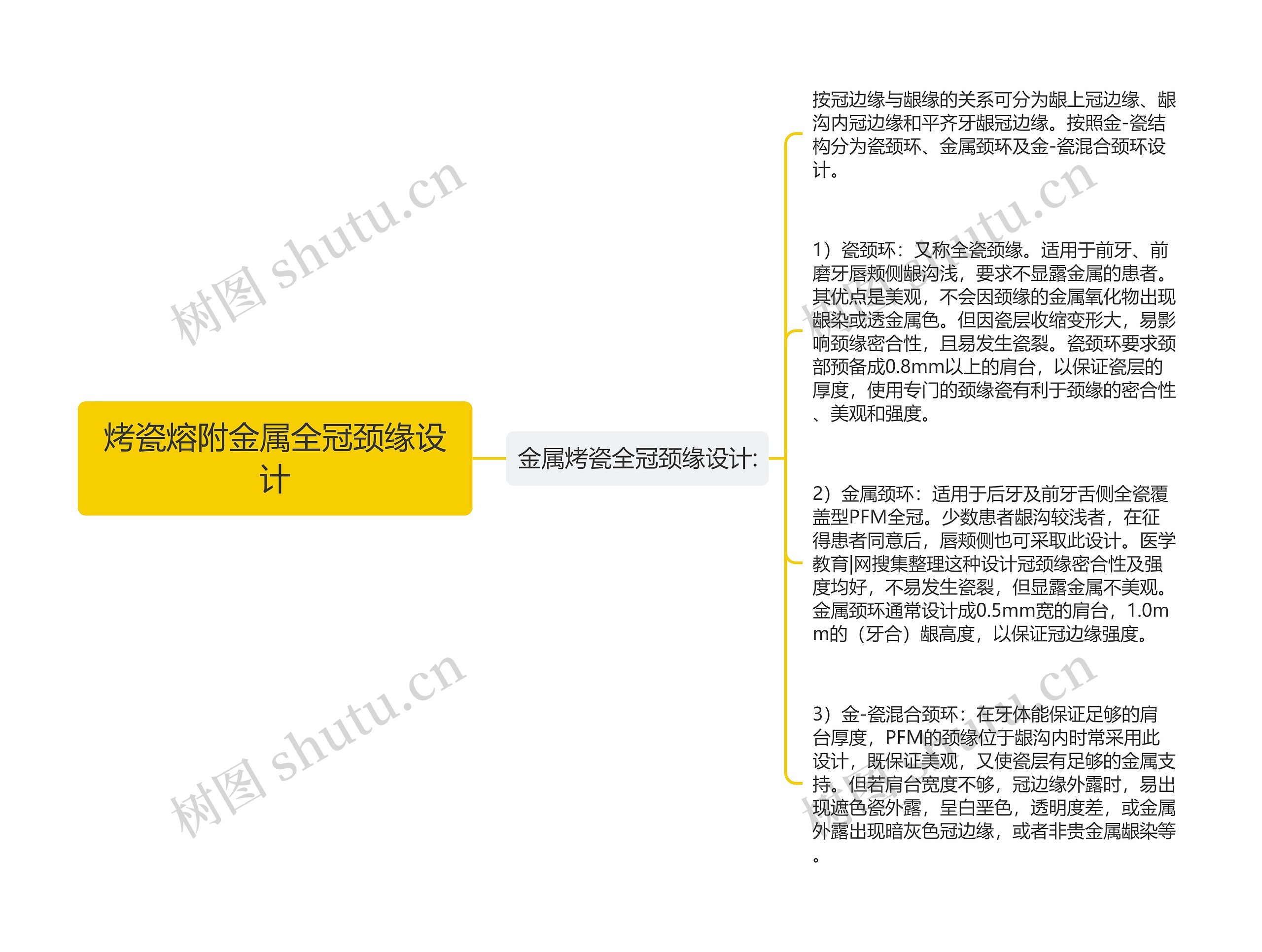 烤瓷熔附金属全冠颈缘设计 烤瓷熔附金属全冠颈缘设计