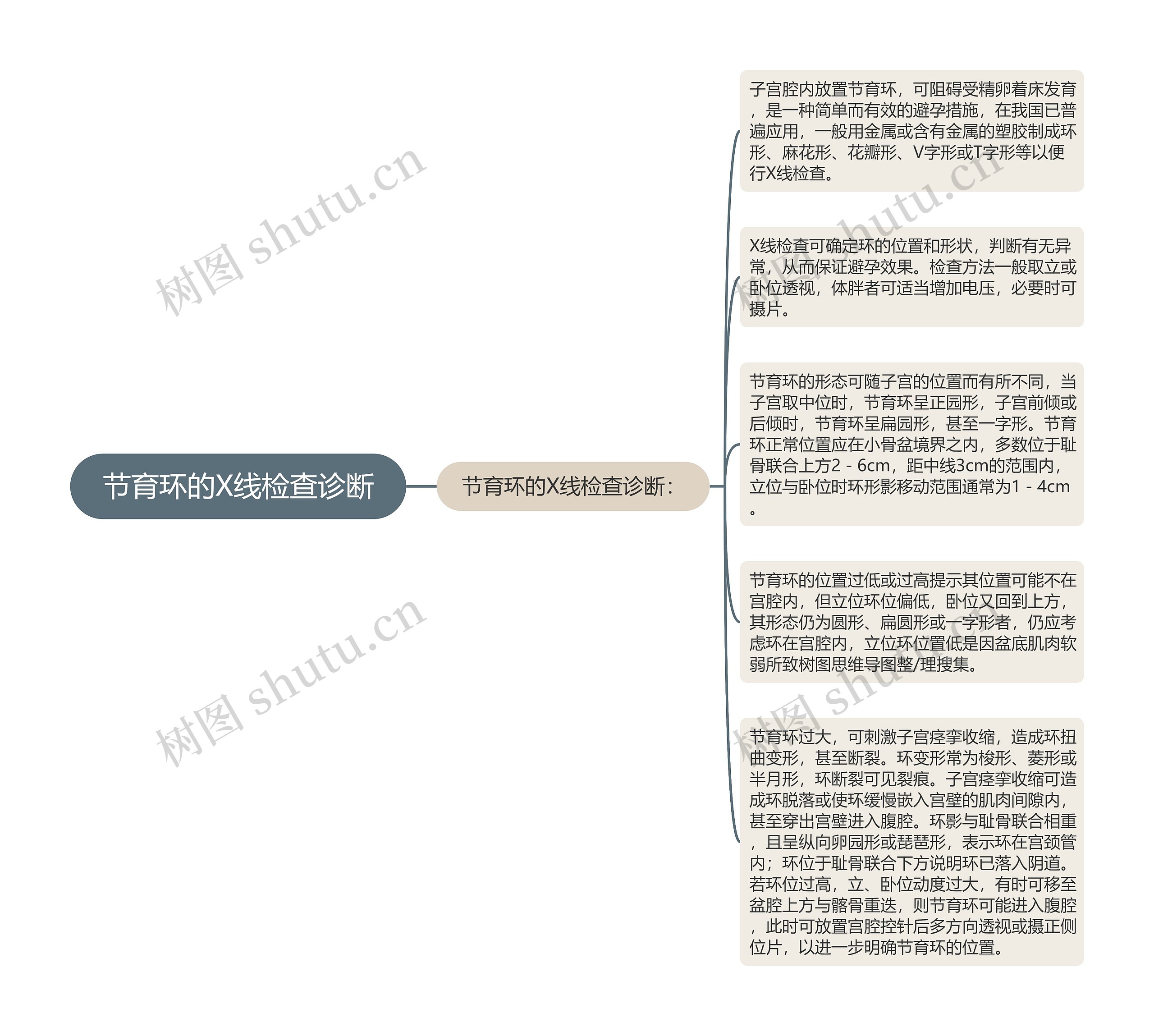 节育环的X线检查诊断思维导图