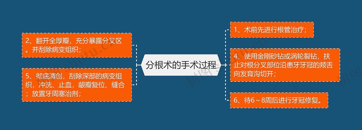 分根术的手术过程思维导图_编号p6767316-TreeMind树图