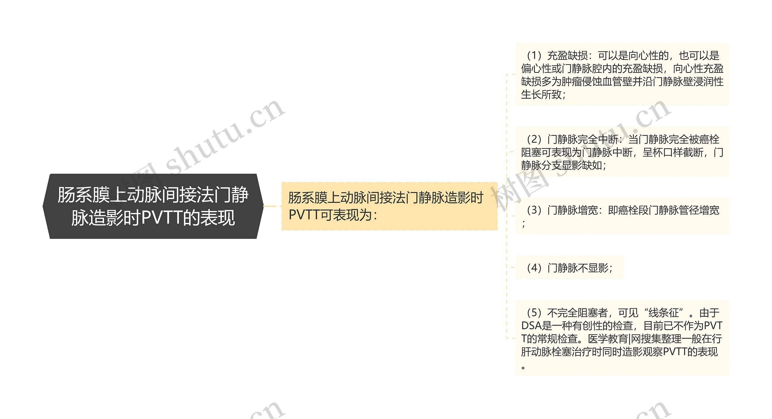肠系膜上动脉间接法门静脉造影时PVTT的表现 肠系膜上动脉间接法门静脉造影时PVTT的表现