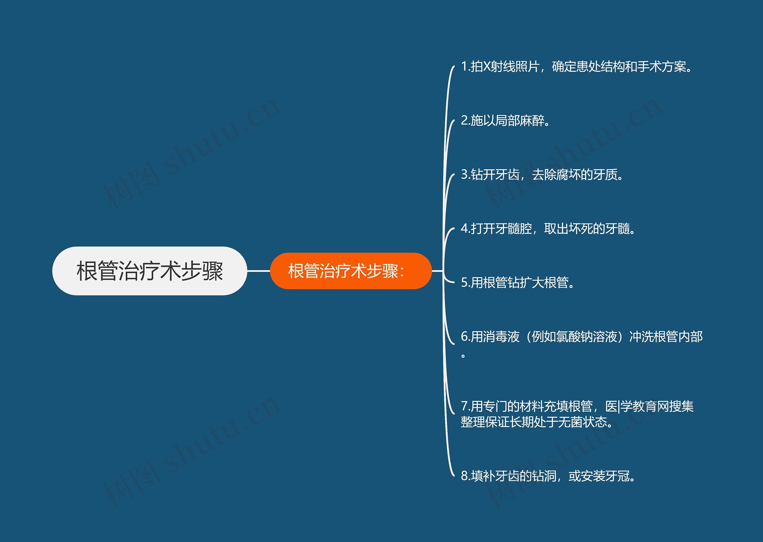 根管治疗术步骤思维导图