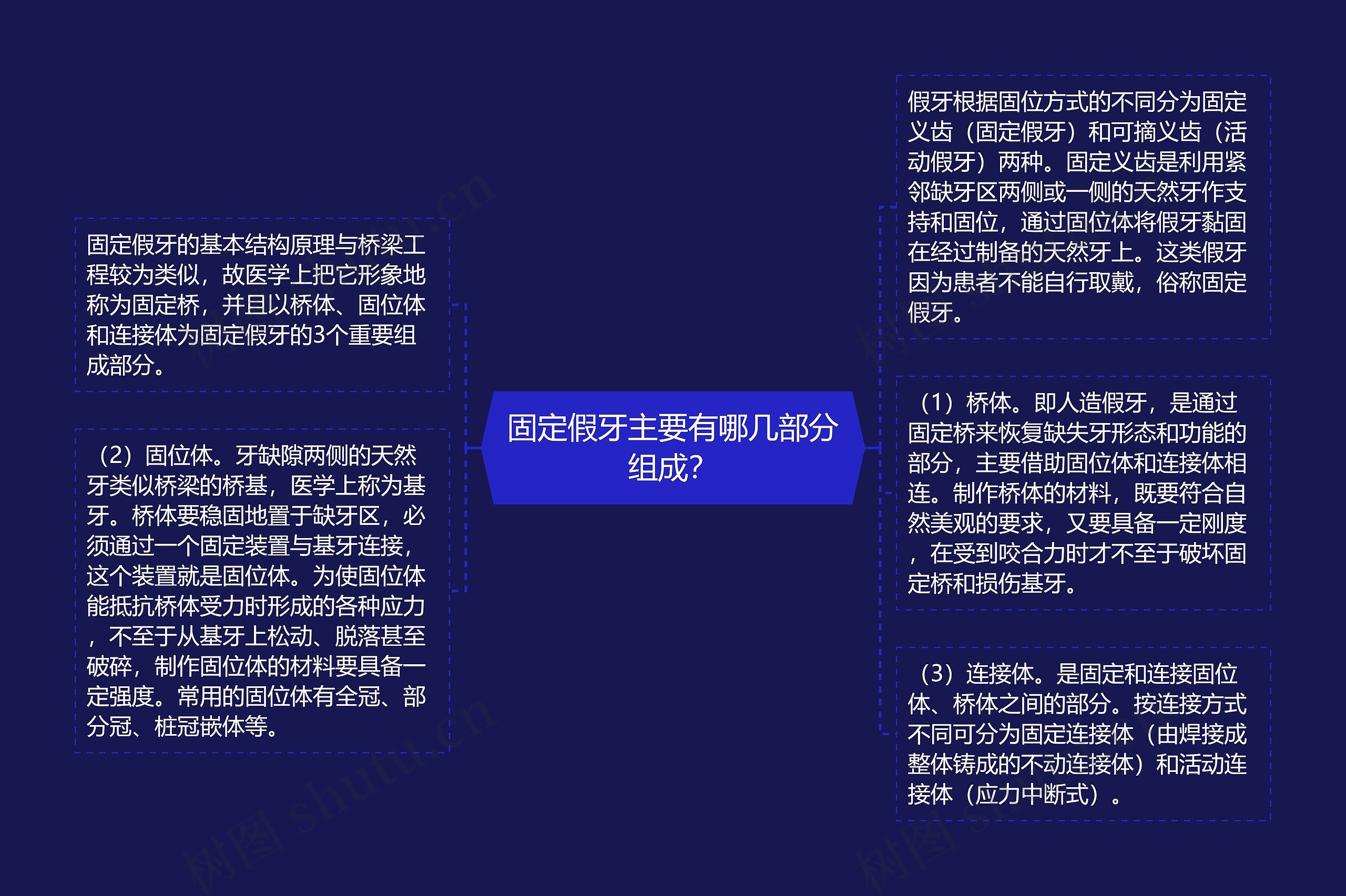 固定假牙主要有哪几部分组成？思维导图