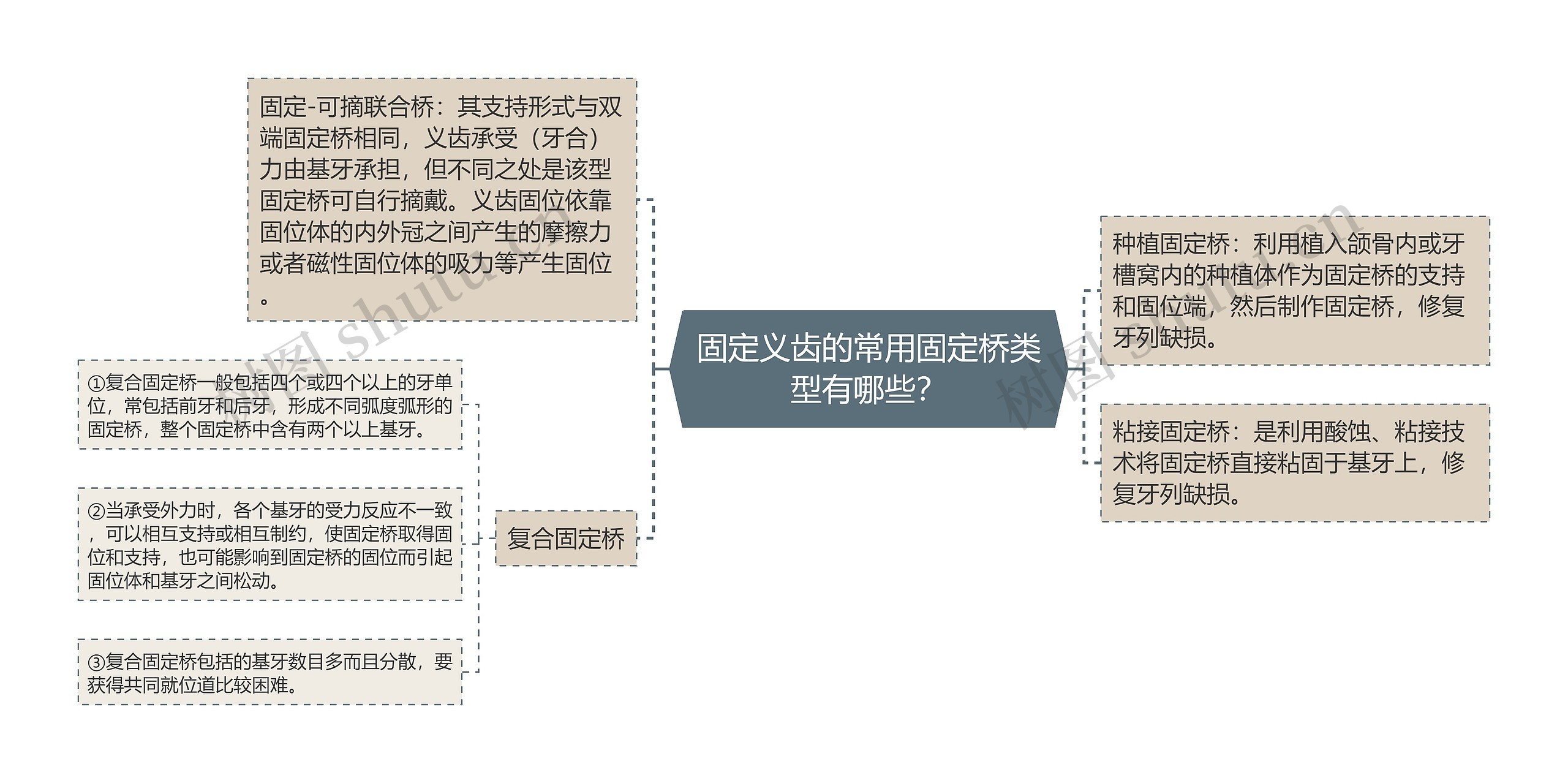 固定义齿的常用固定桥类型有哪些？