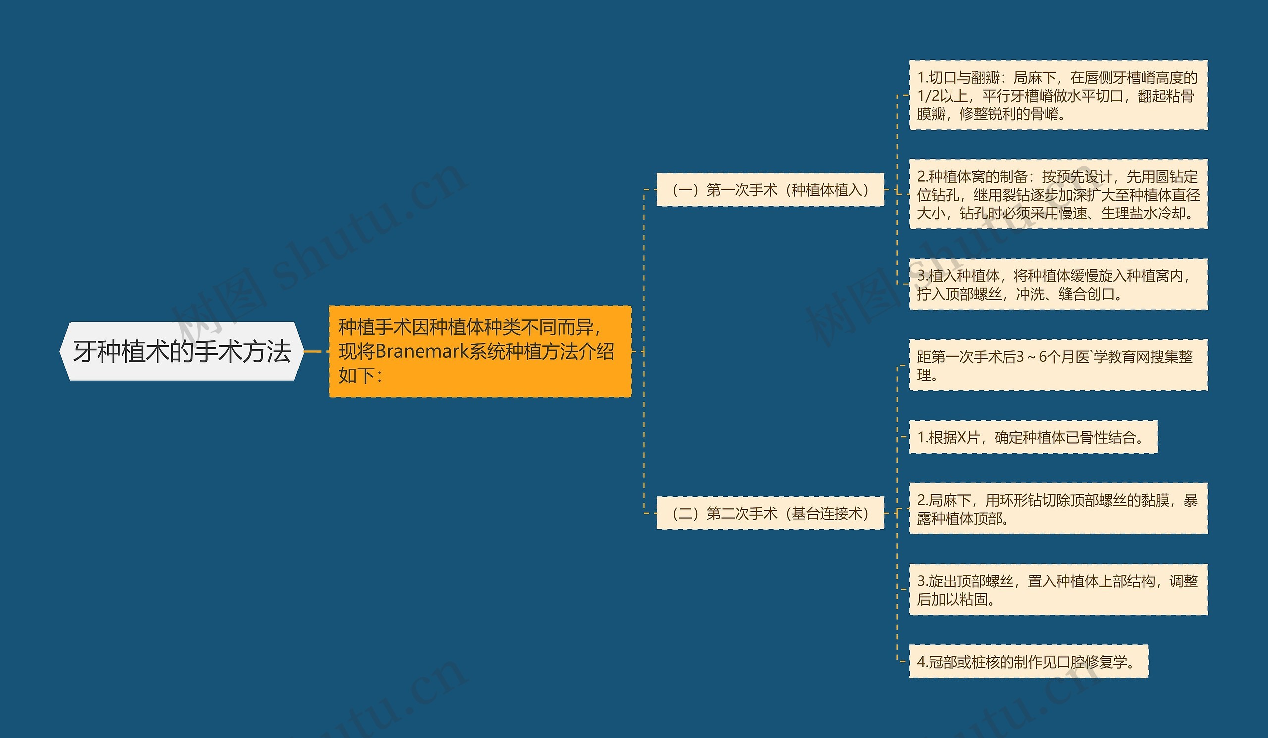 牙种植术的手术方法思维导图