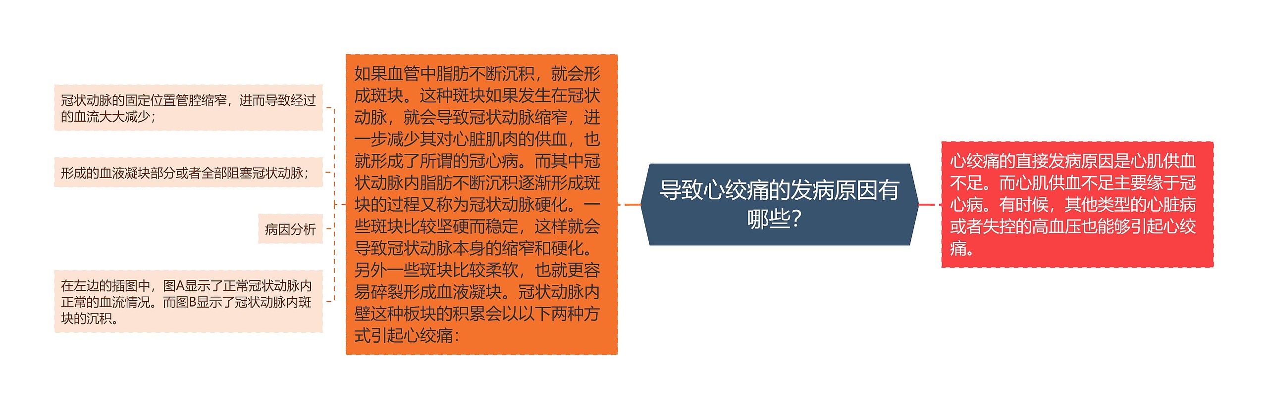 导致心绞痛的发病原因有哪些? 导致心绞痛的发病原因有哪些?