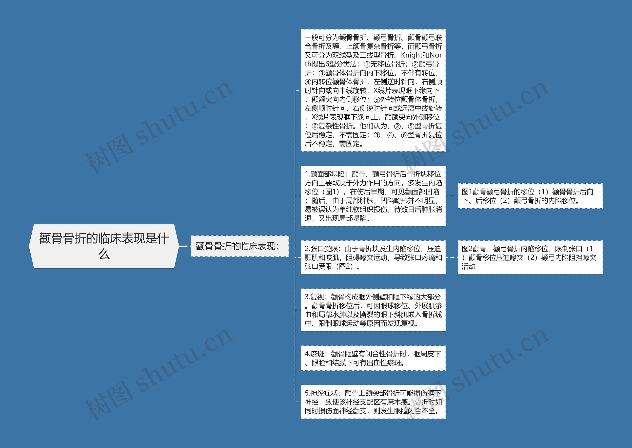 颧骨骨折的临床表现是什么