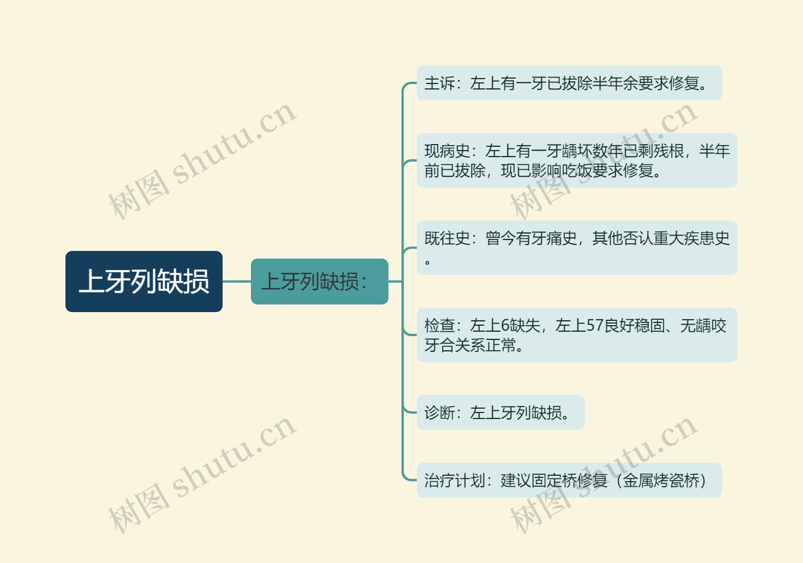 上牙列缺损思维导图