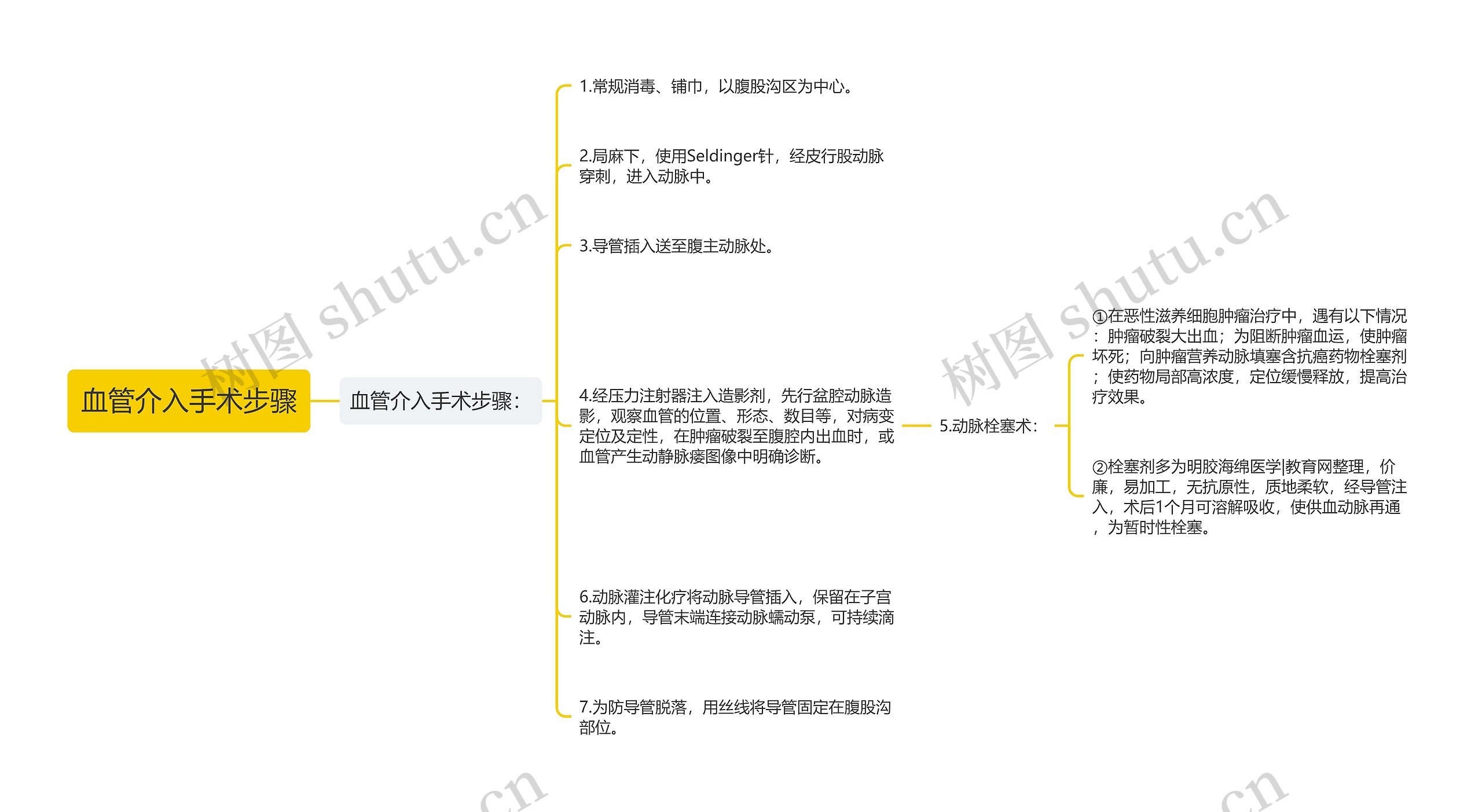 血管介入手术步骤思维导图