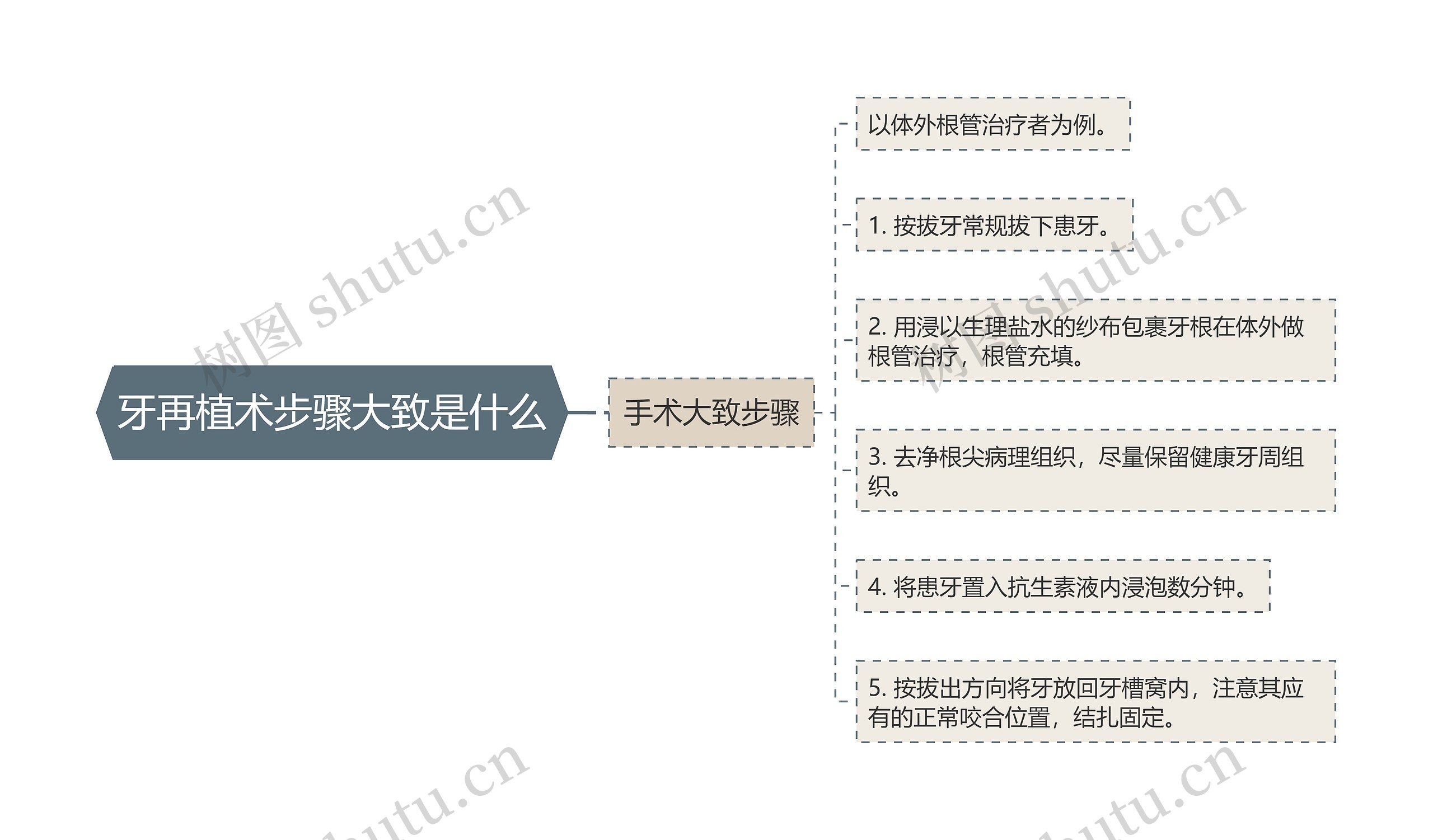 牙再植术步骤大致是什么 牙再植术步骤大致是什么