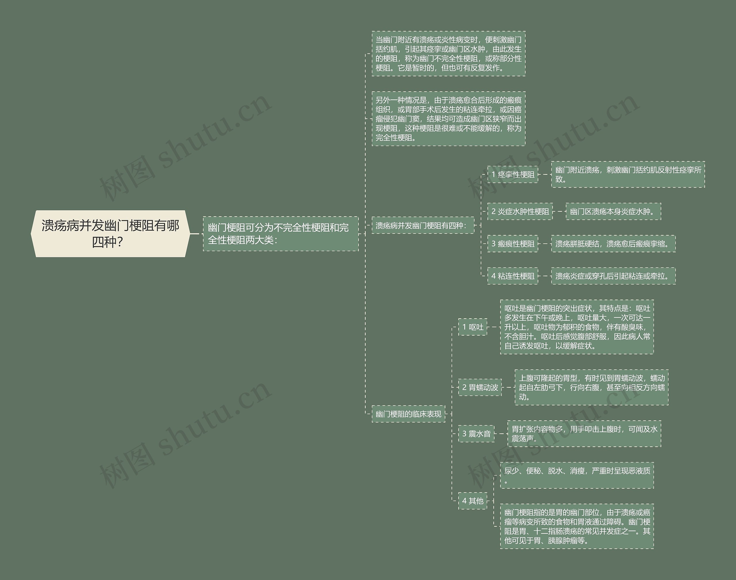溃疡病并发幽门梗阻有哪四种？思维导图