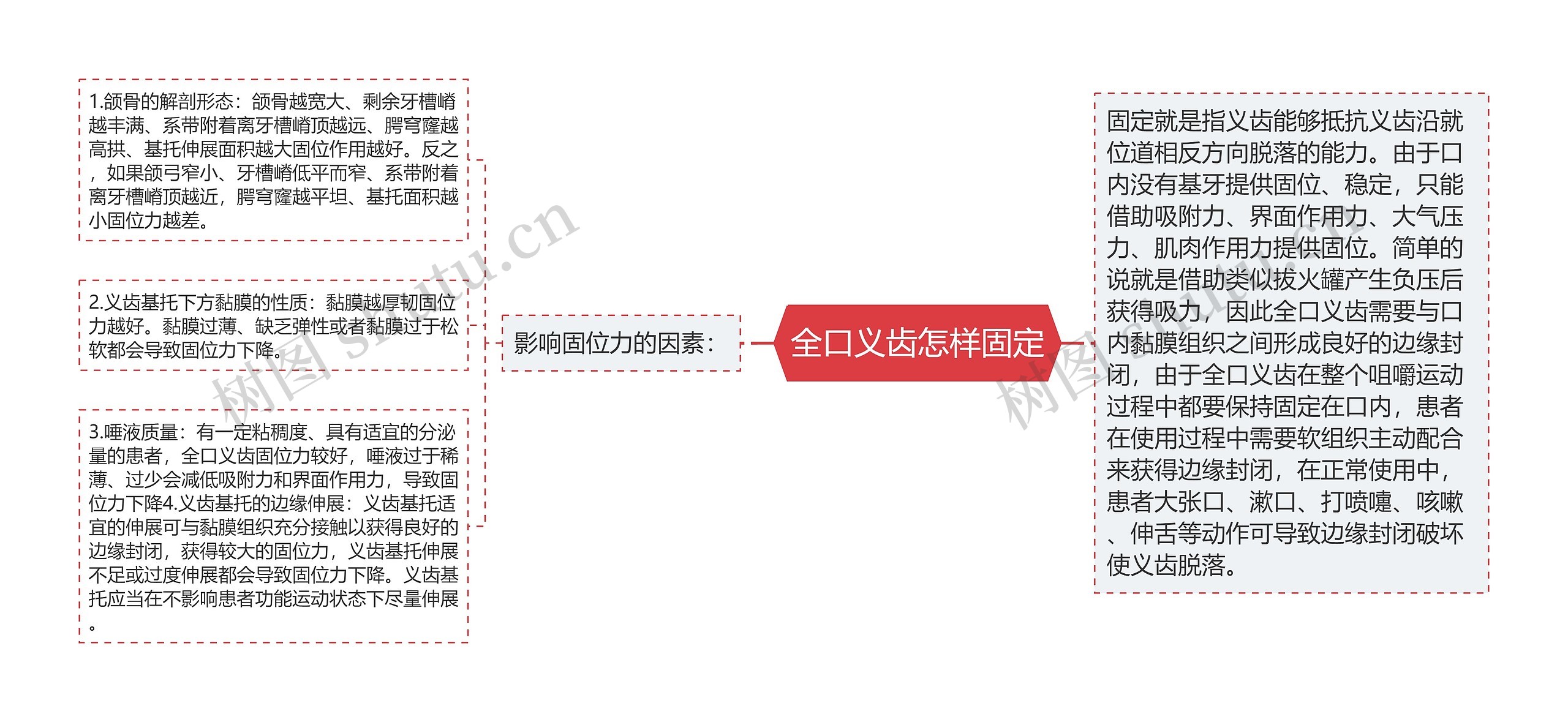 全口义齿怎样固定思维导图