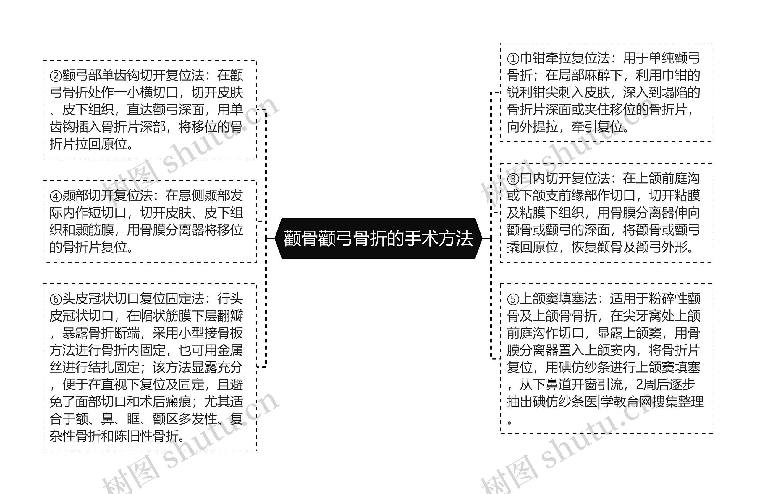 颧骨颧弓骨折的手术方法思维导图