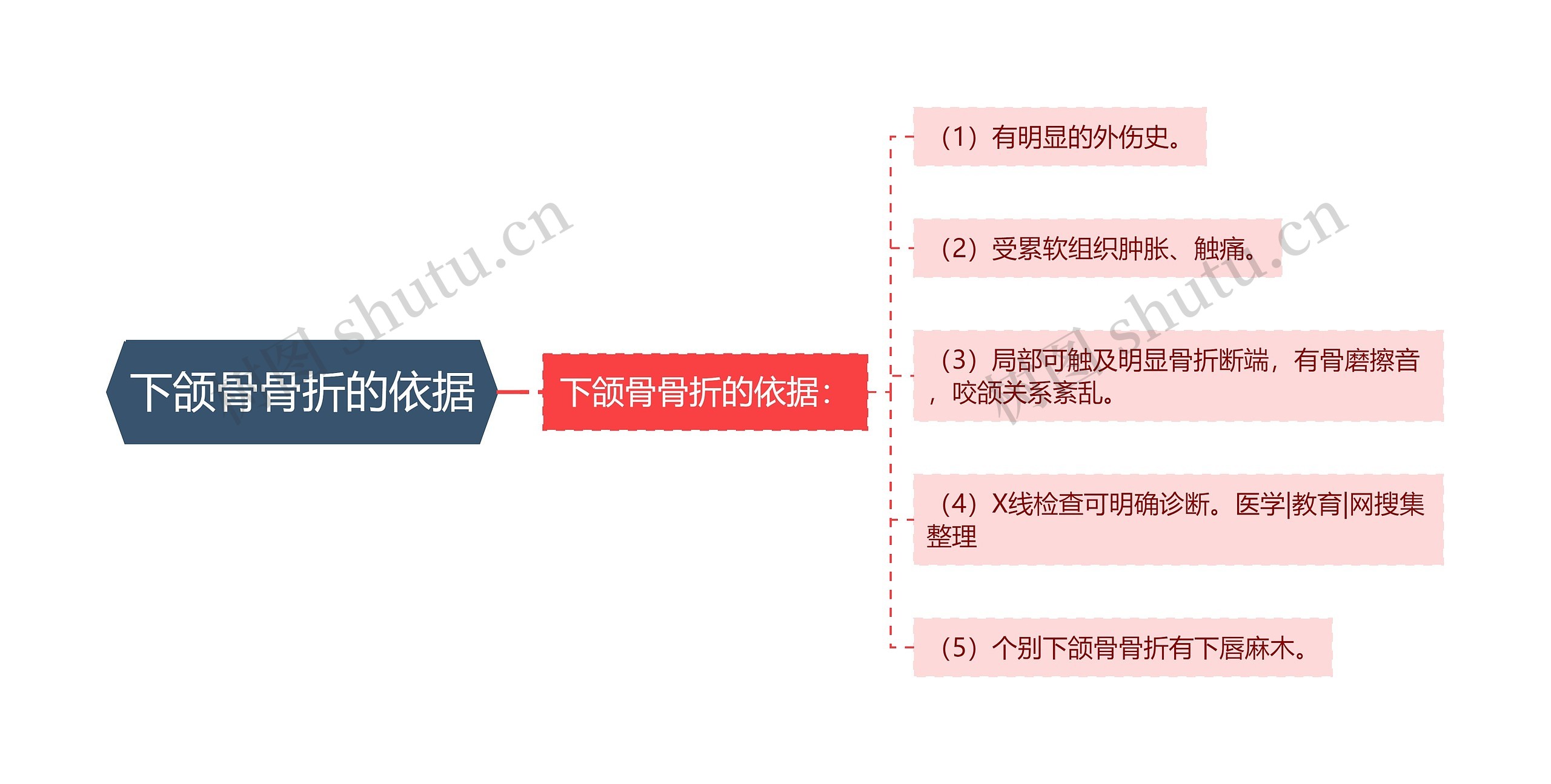 下颌骨骨折的依据思维导图