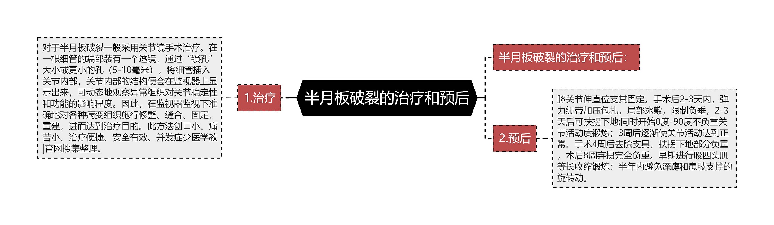 半月板破裂的治疗和预后思维导图