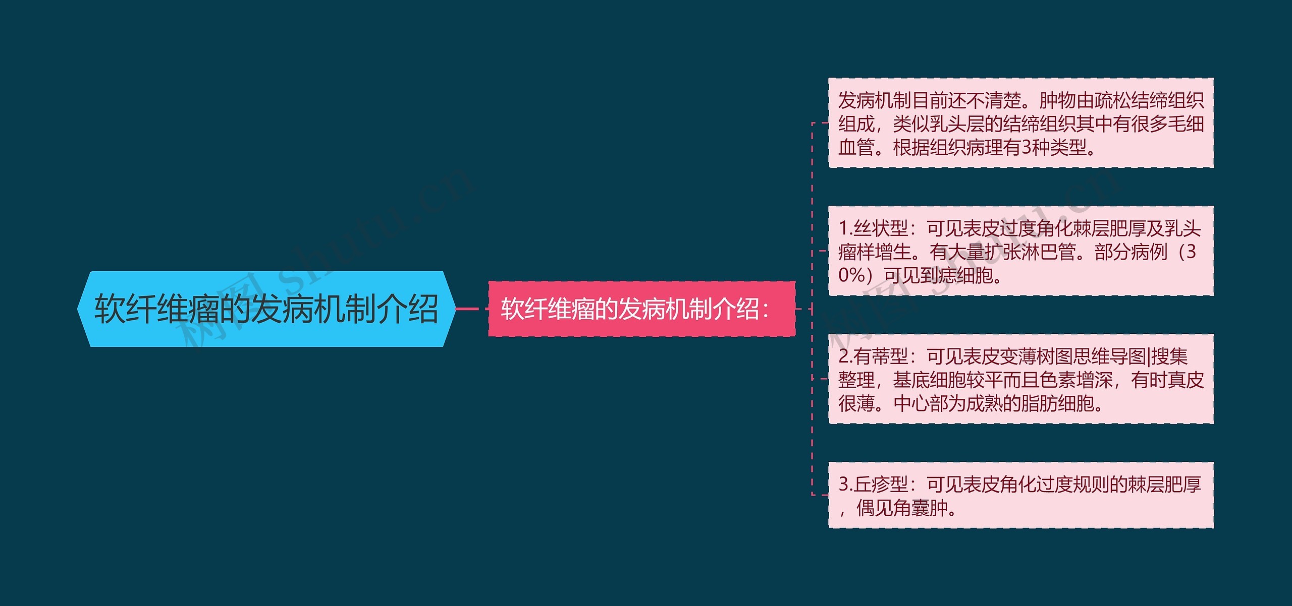 软纤维瘤的发病机制介绍思维导图