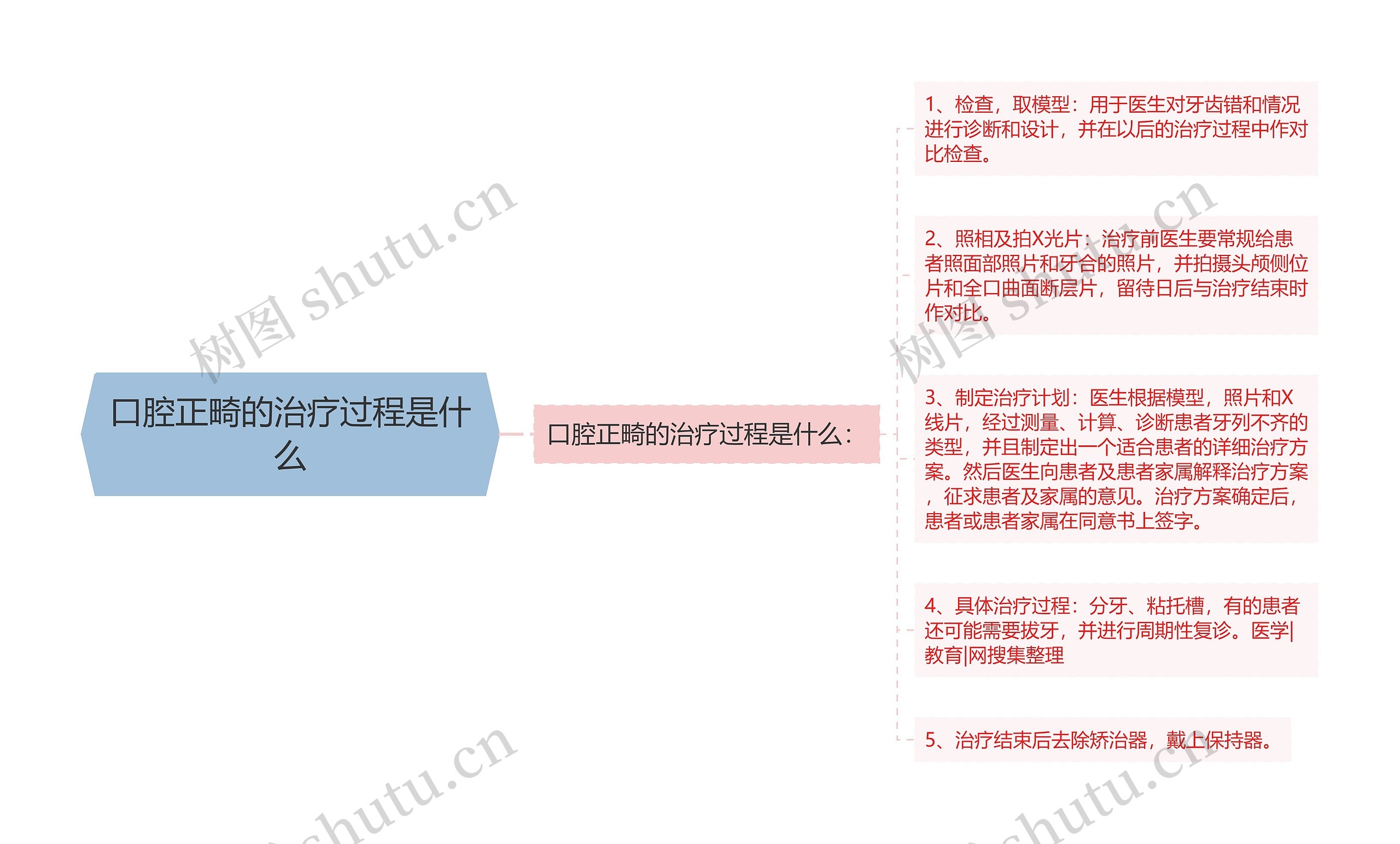 口腔正畸的治疗过程是什么思维导图