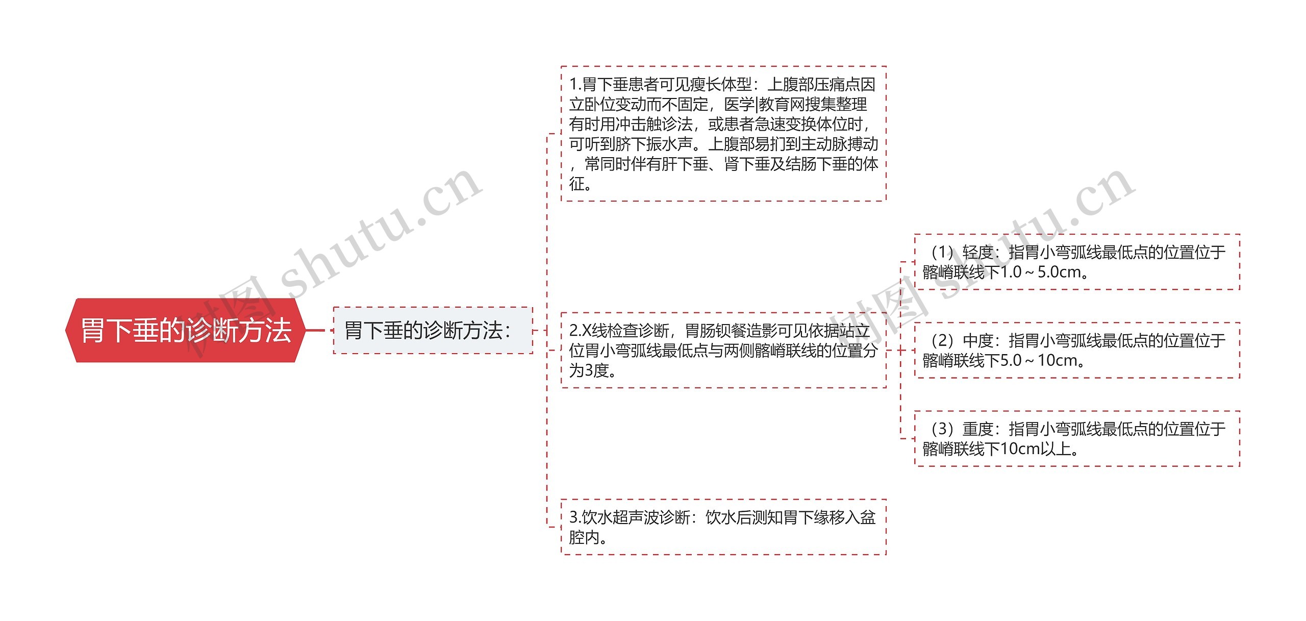 胃下垂的诊断方法思维导图