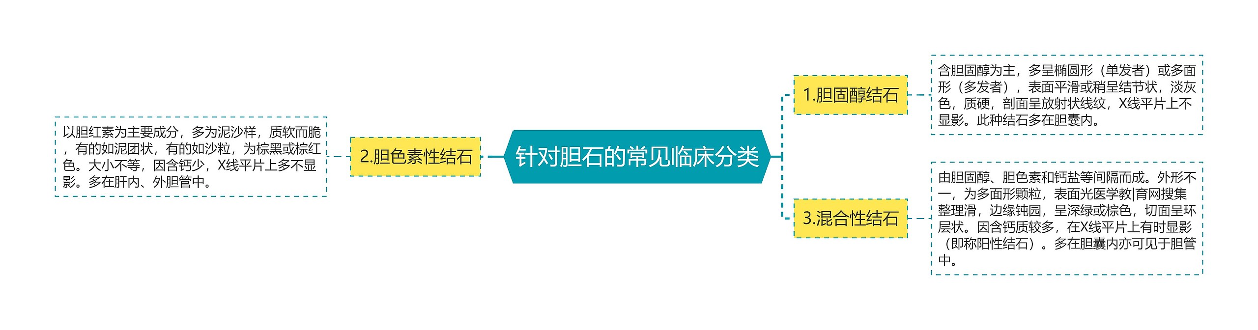 针对胆石的常见临床分类 针对胆石的常见临床分类