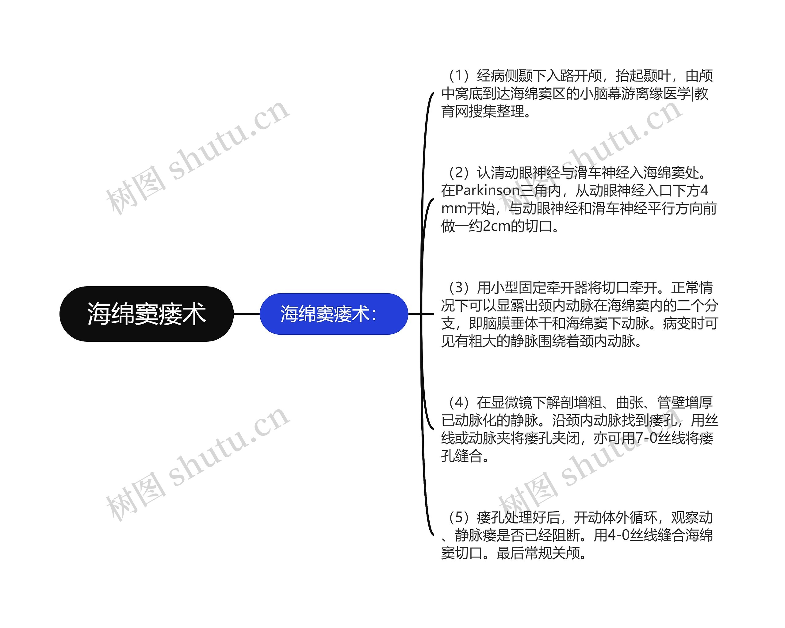 海绵窦瘘术