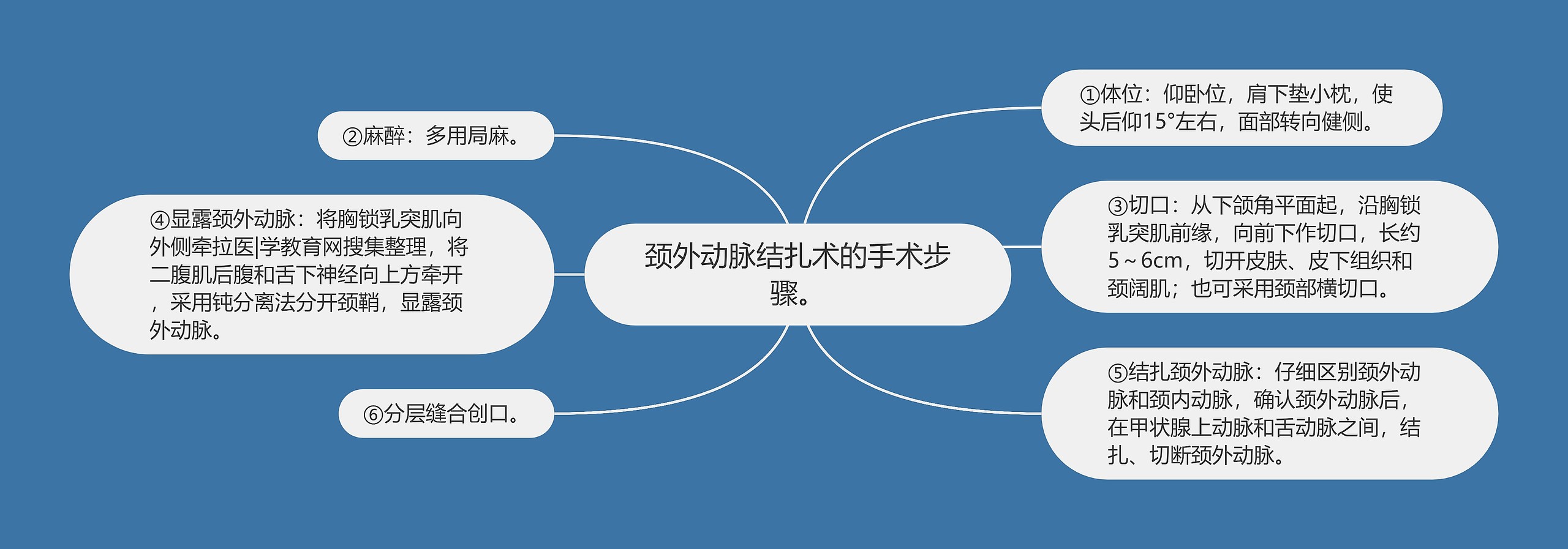 颈外动脉结扎术的手术步骤。 颈外动脉结扎术的手术步骤。