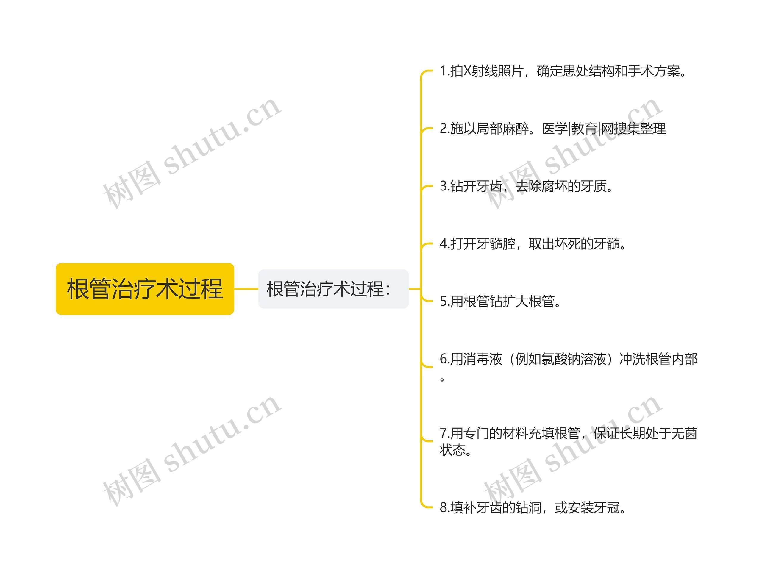 根管治疗术过程思维导图