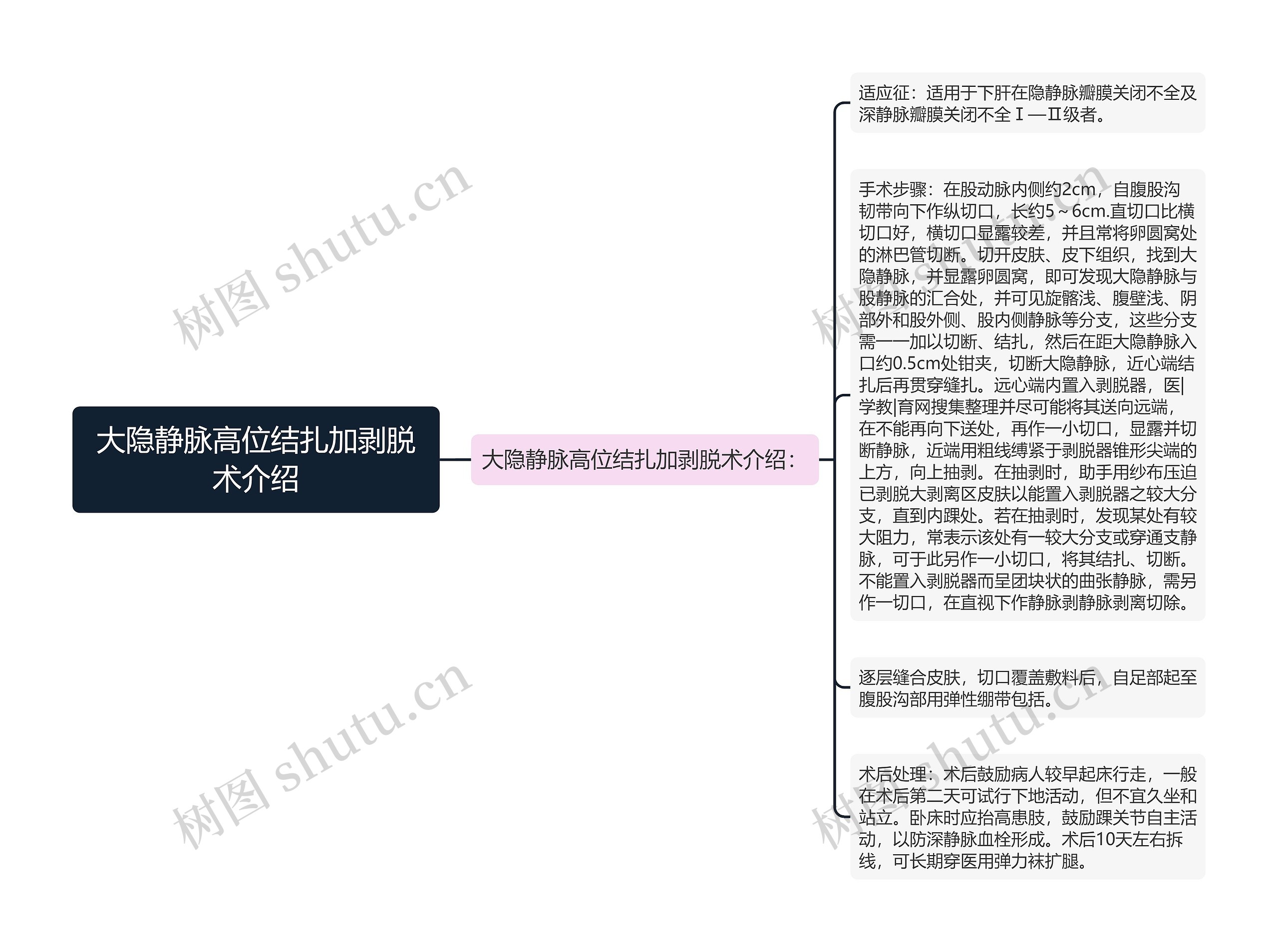 大隐静脉高位结扎加剥脱术介绍思维导图