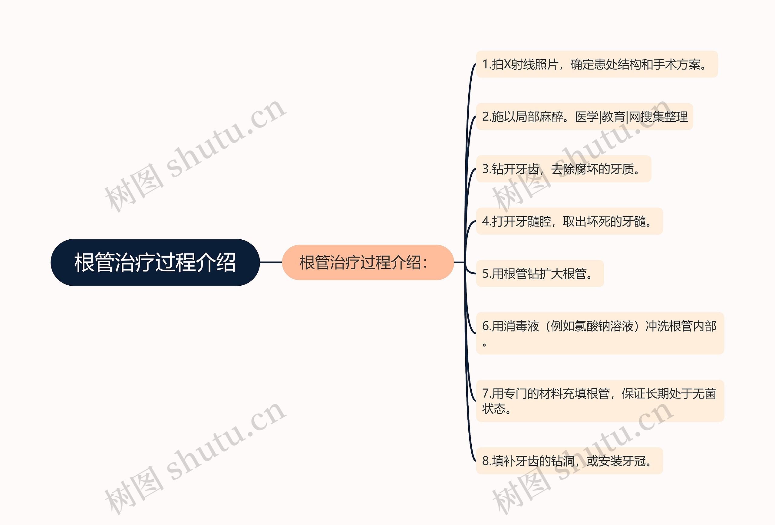 根管治疗过程介绍