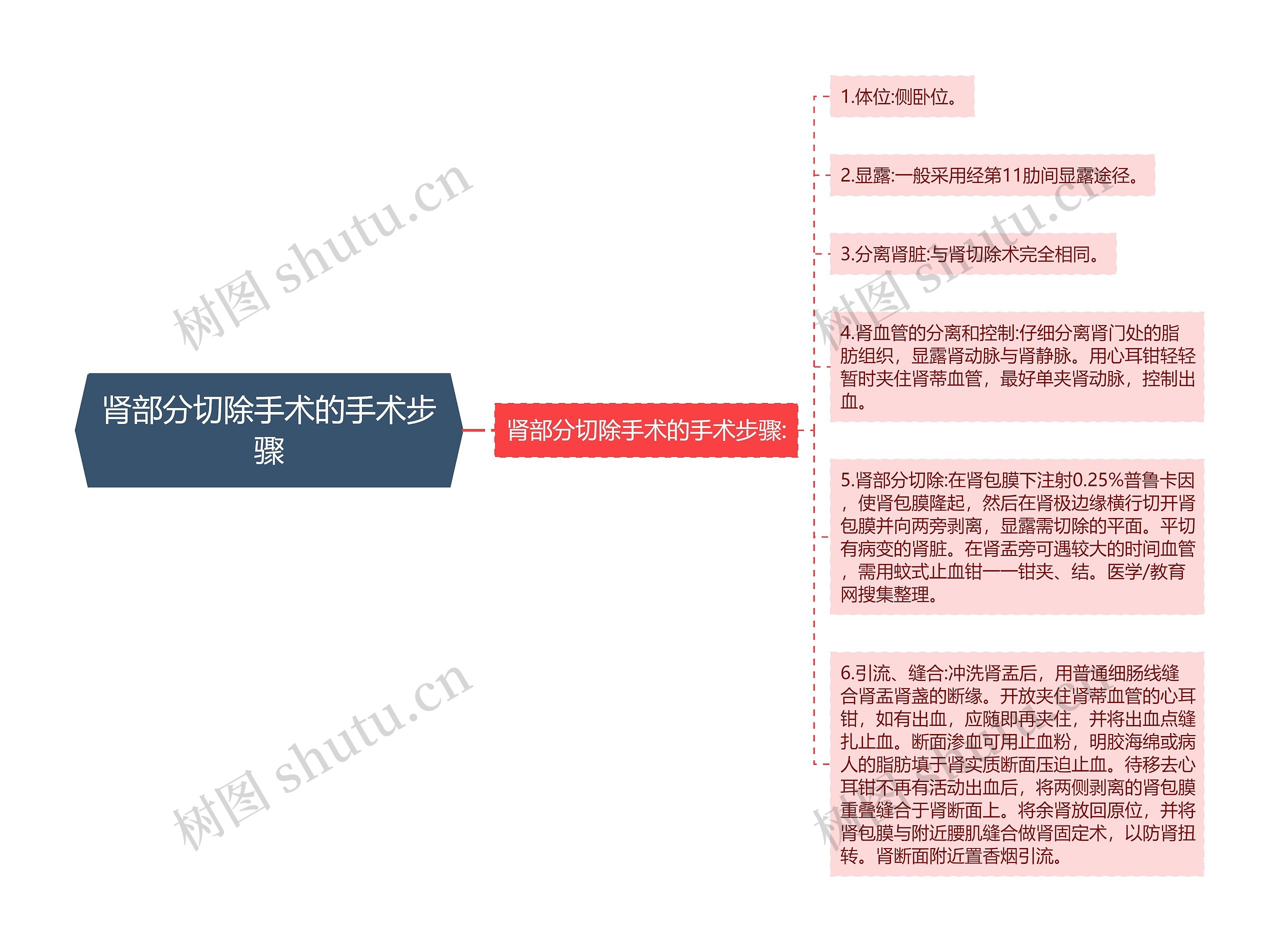 肾部分切除手术的手术步骤思维导图