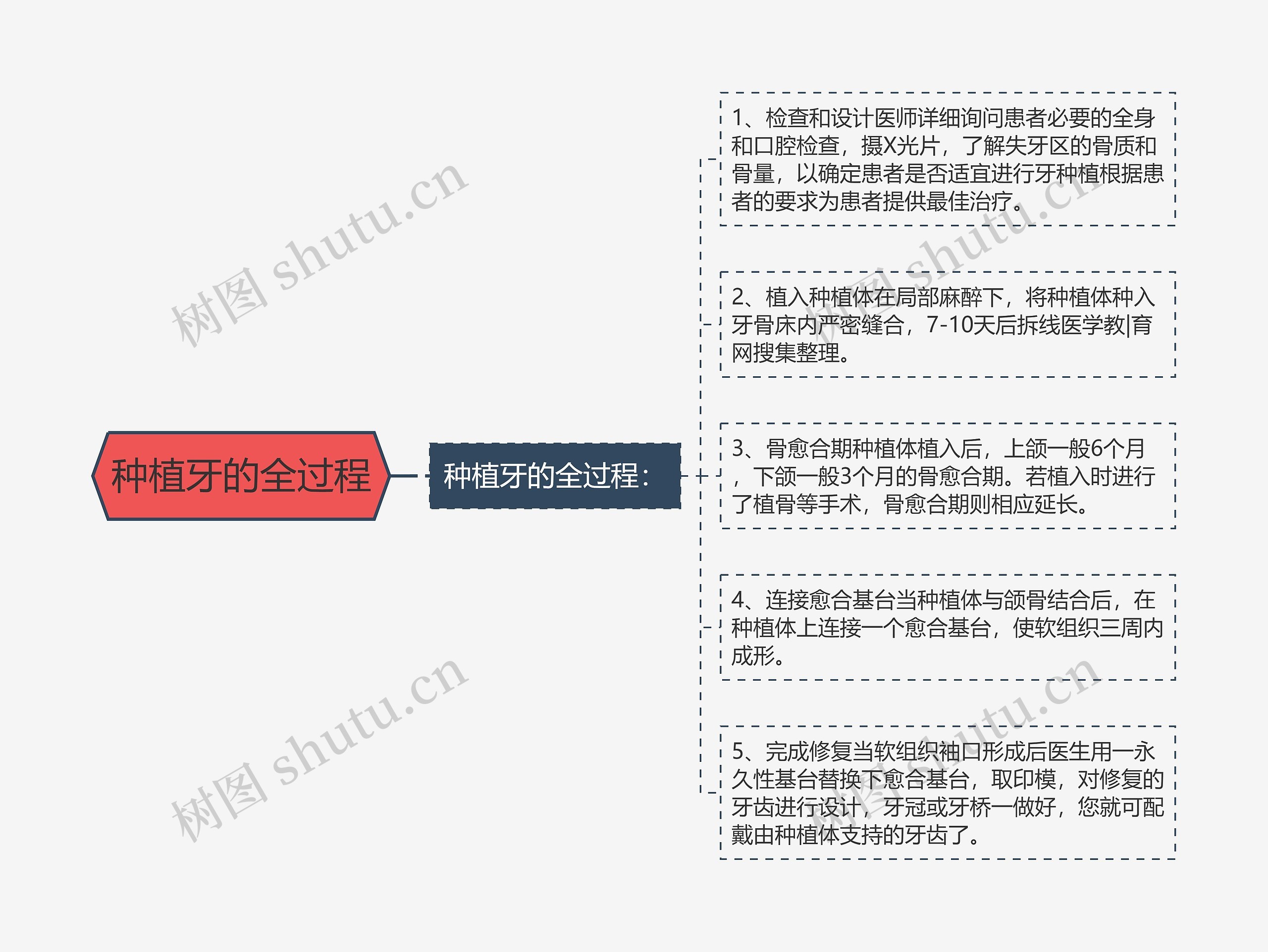 种植牙的全过程思维导图