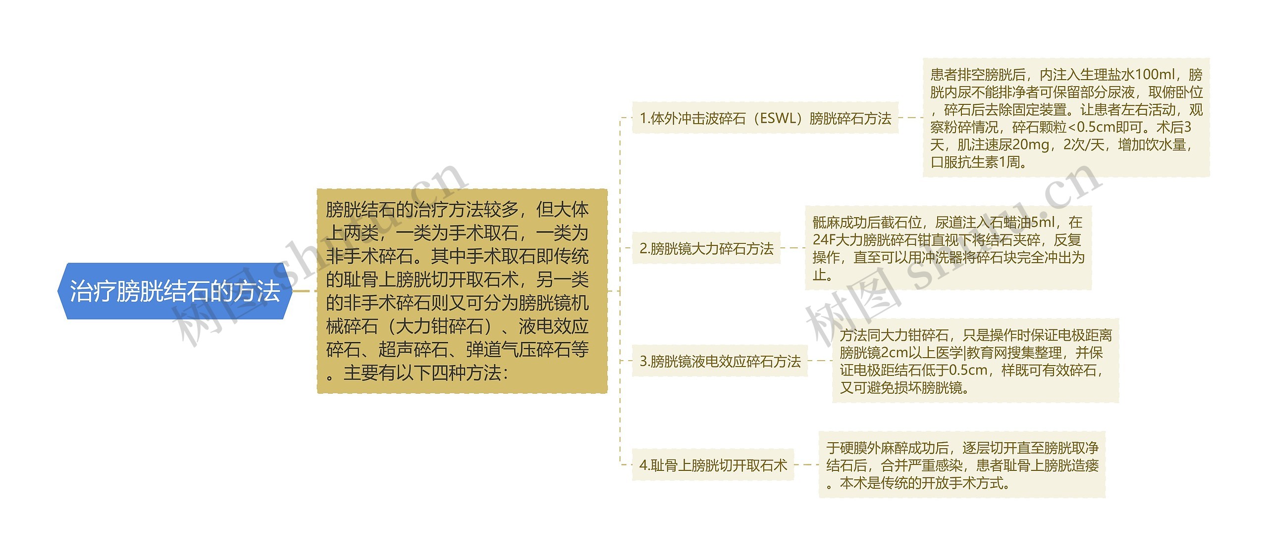 治疗膀胱结石的方法思维导图