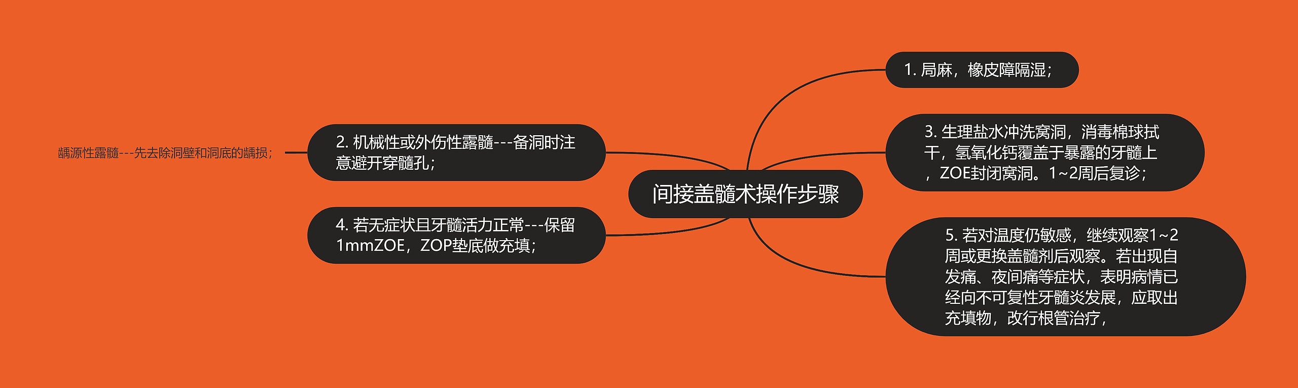 间接盖髓术操作步骤 间接盖髓术操作步骤
