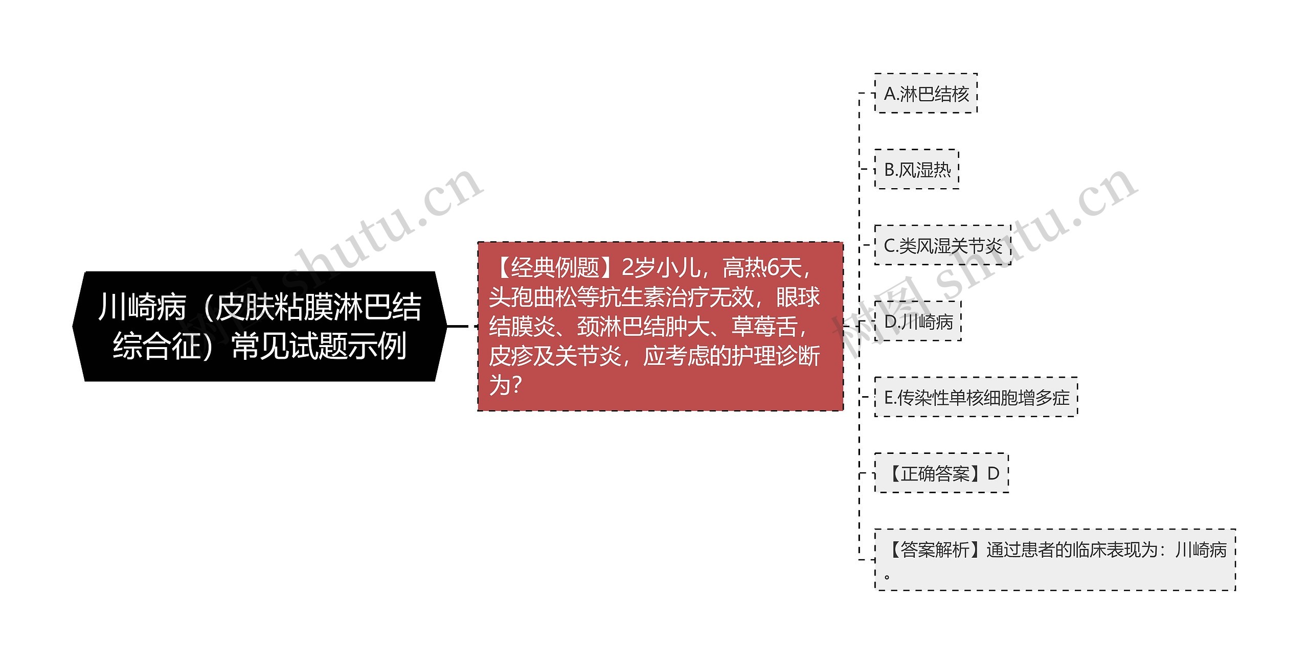 川崎病（皮肤粘膜淋巴结综合征）常见试题示例思维导图